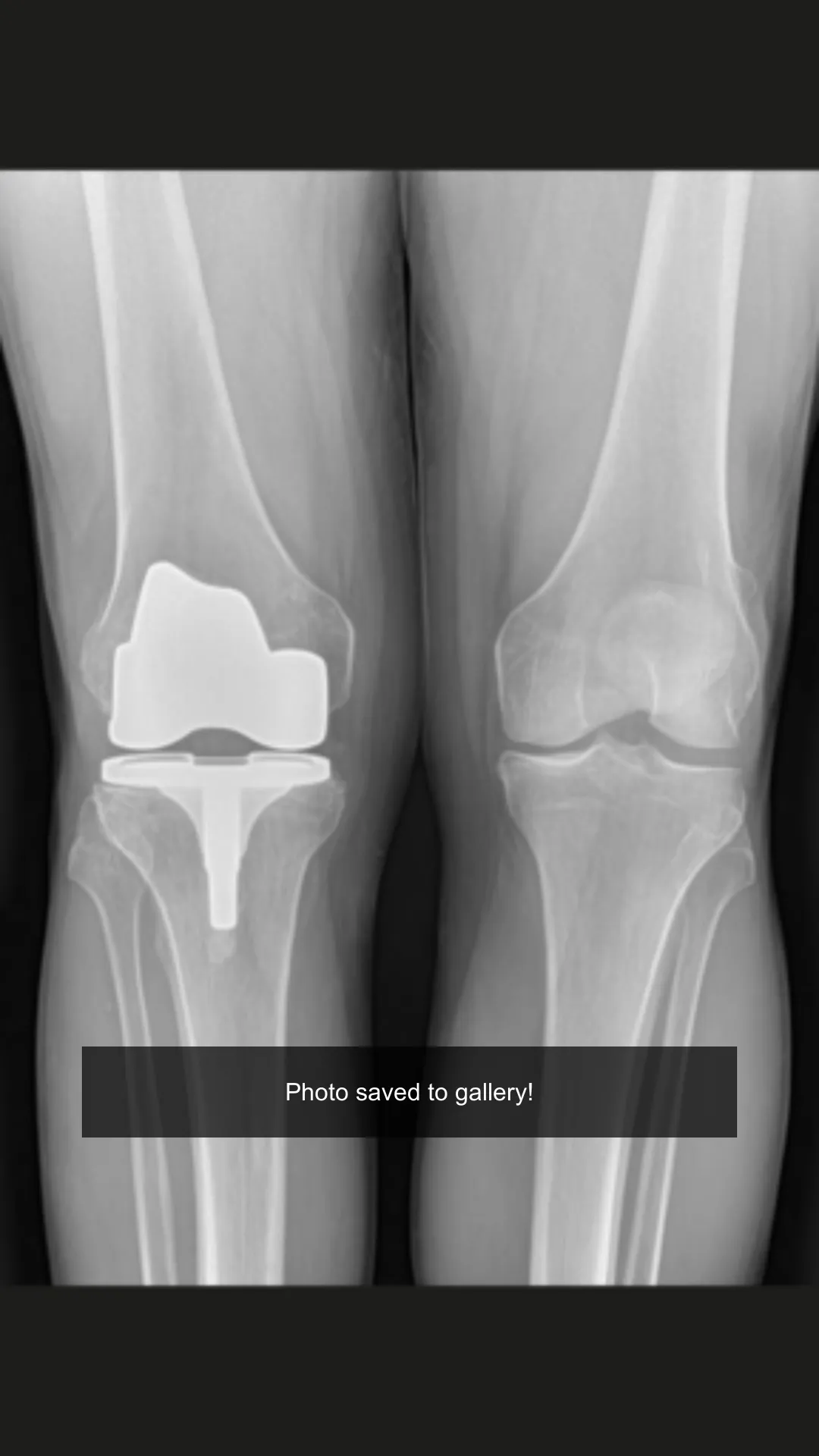 Xray scan filter camera | Indus Appstore | Screenshot