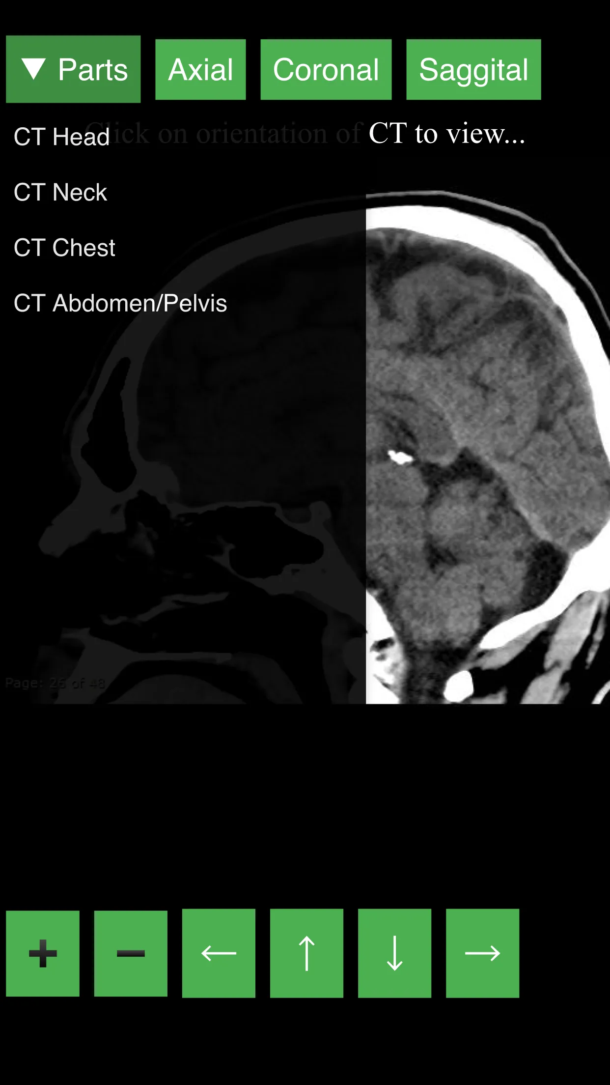 Radiology CT Viewer | Indus Appstore | Screenshot