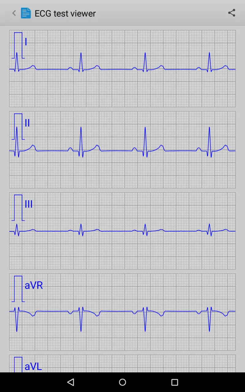 Istel ECG | Indus Appstore | Screenshot