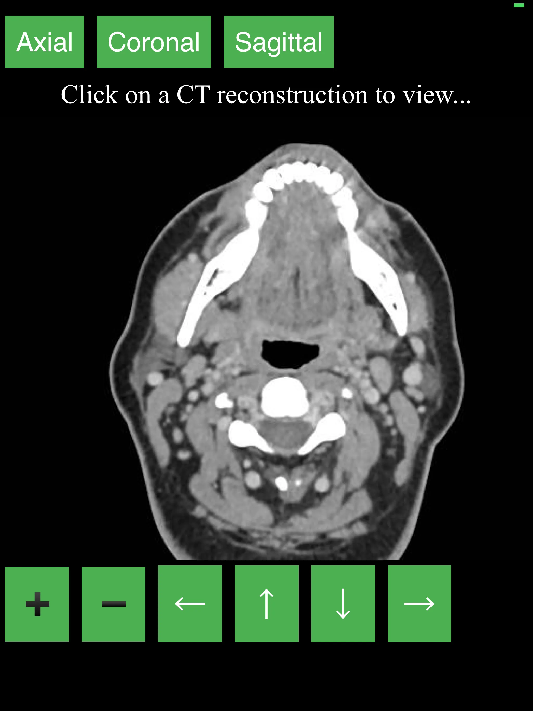 CT Neck | Indus Appstore | Screenshot