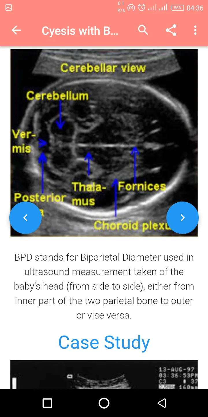 A-Z Obstetrics Ultrasound Guid | Indus Appstore | Screenshot