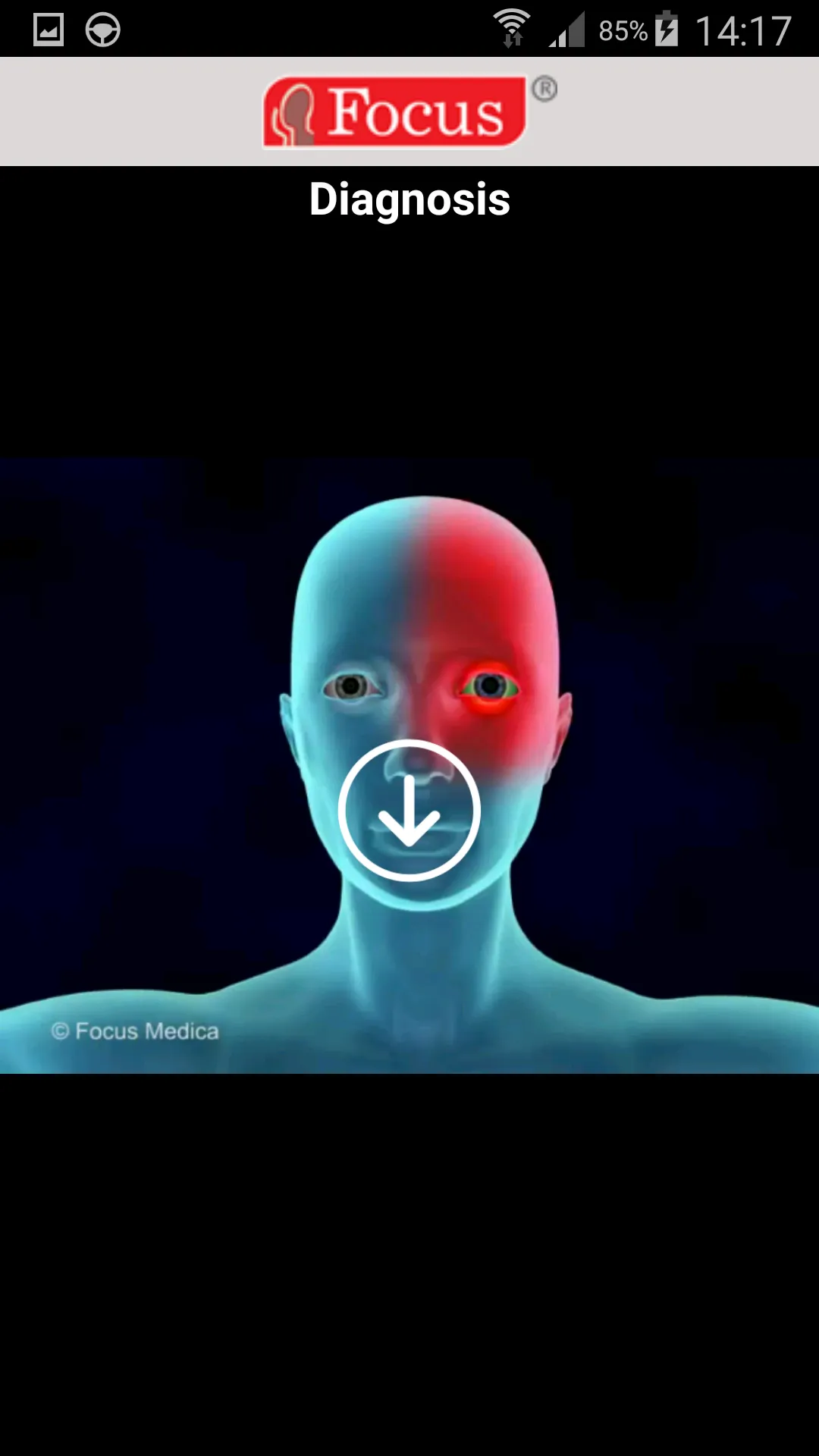 Migraine | Indus Appstore | Screenshot