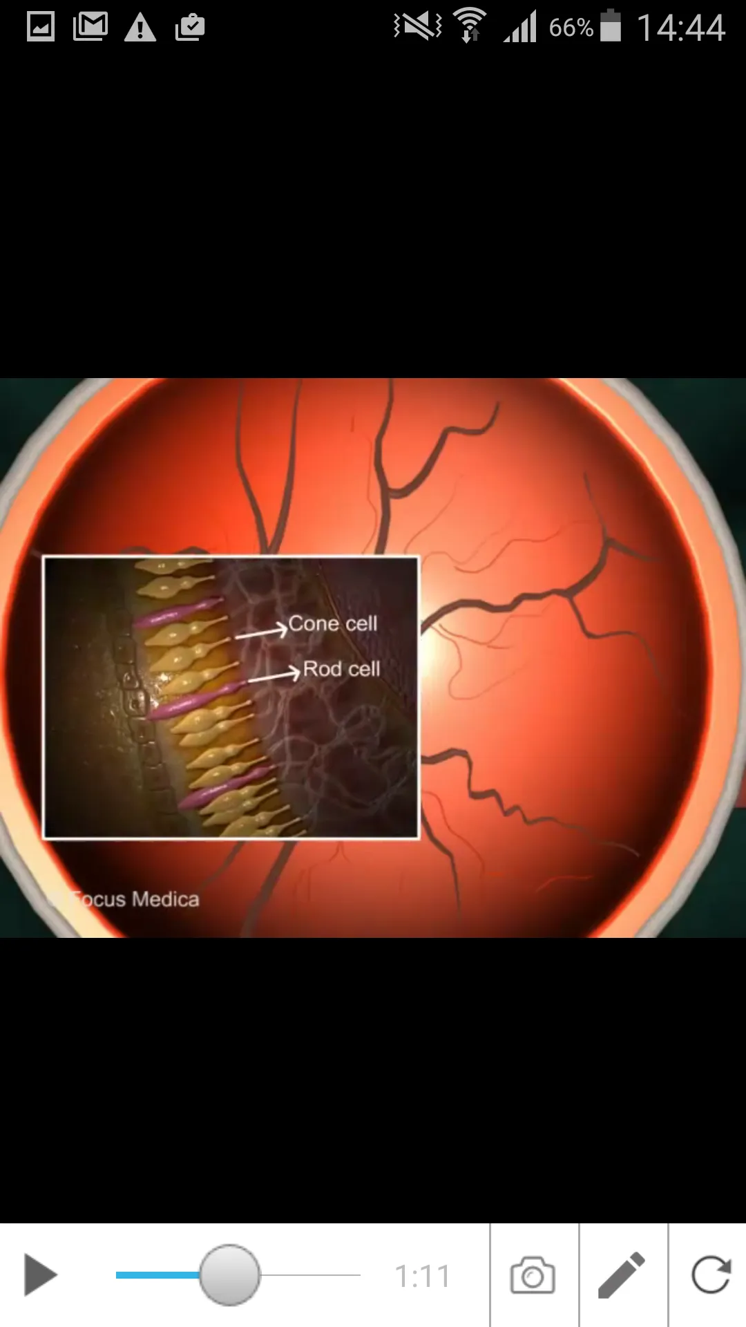 Glaucoma (An Overview) | Indus Appstore | Screenshot