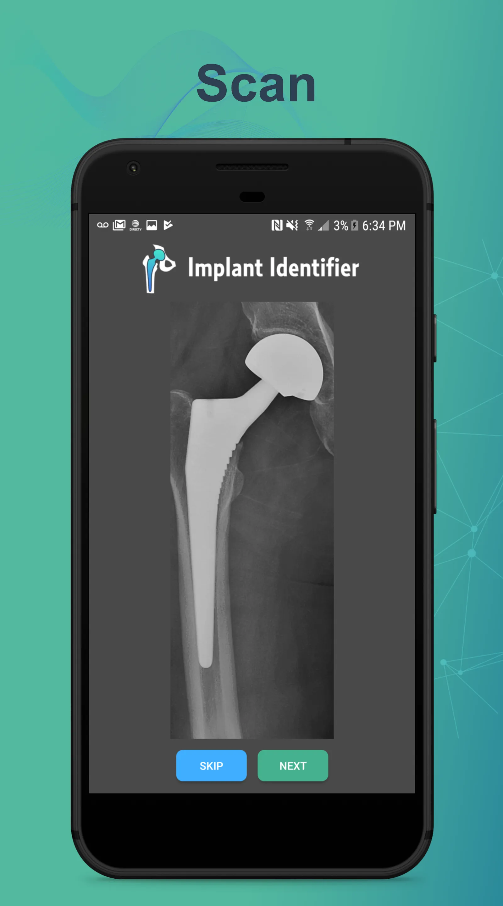 Implant Identifier | Indus Appstore | Screenshot