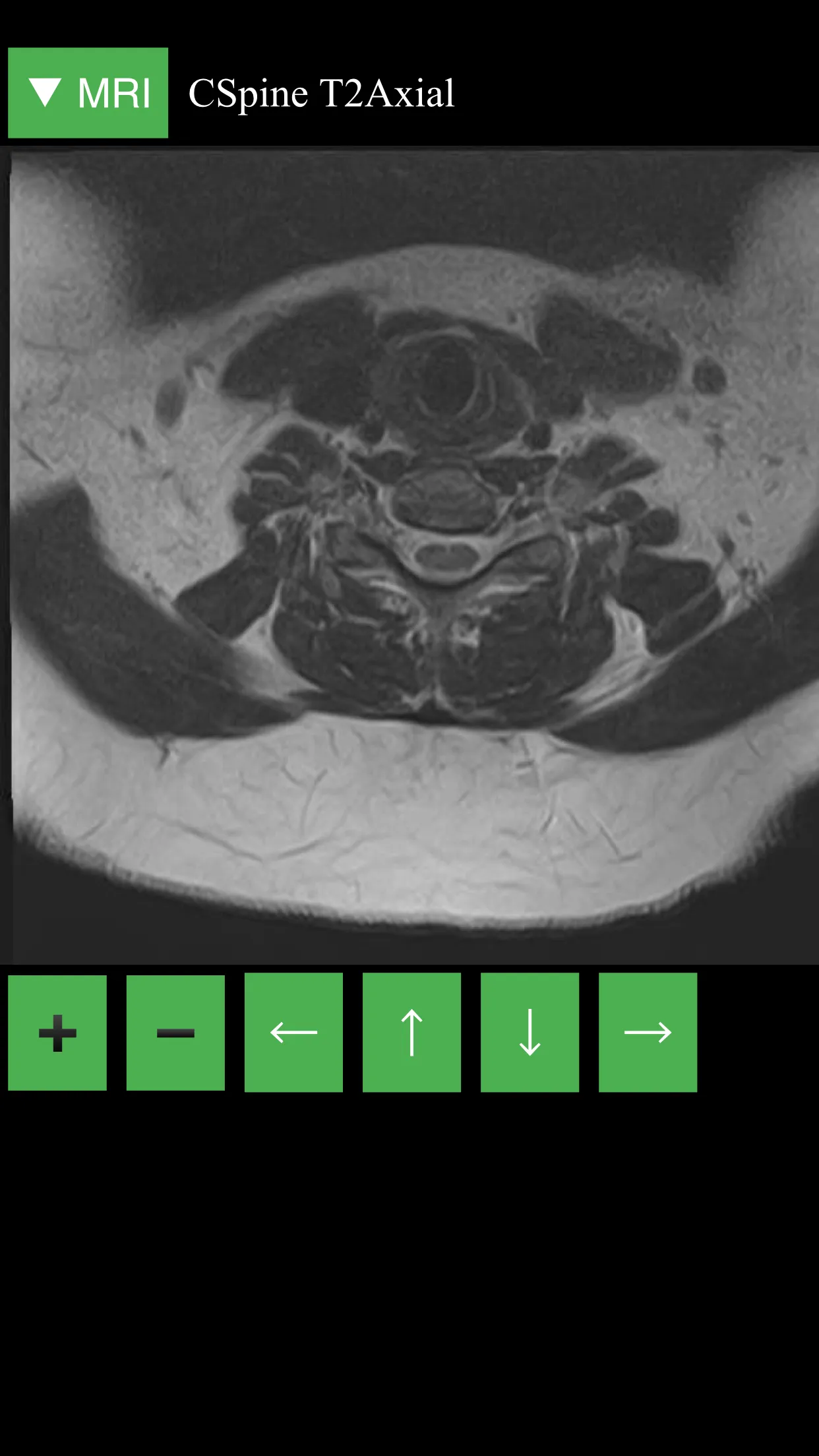 MRI Viewer | Indus Appstore | Screenshot