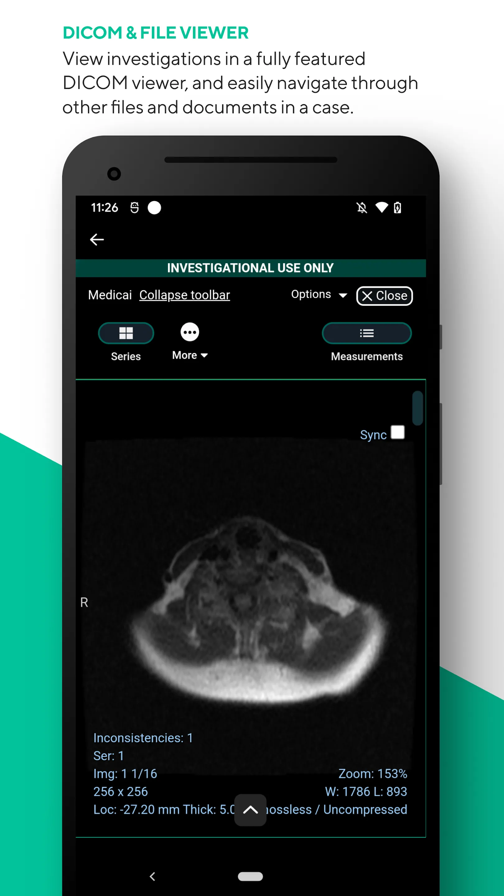 Medicai DICOM Workflows & PACS | Indus Appstore | Screenshot