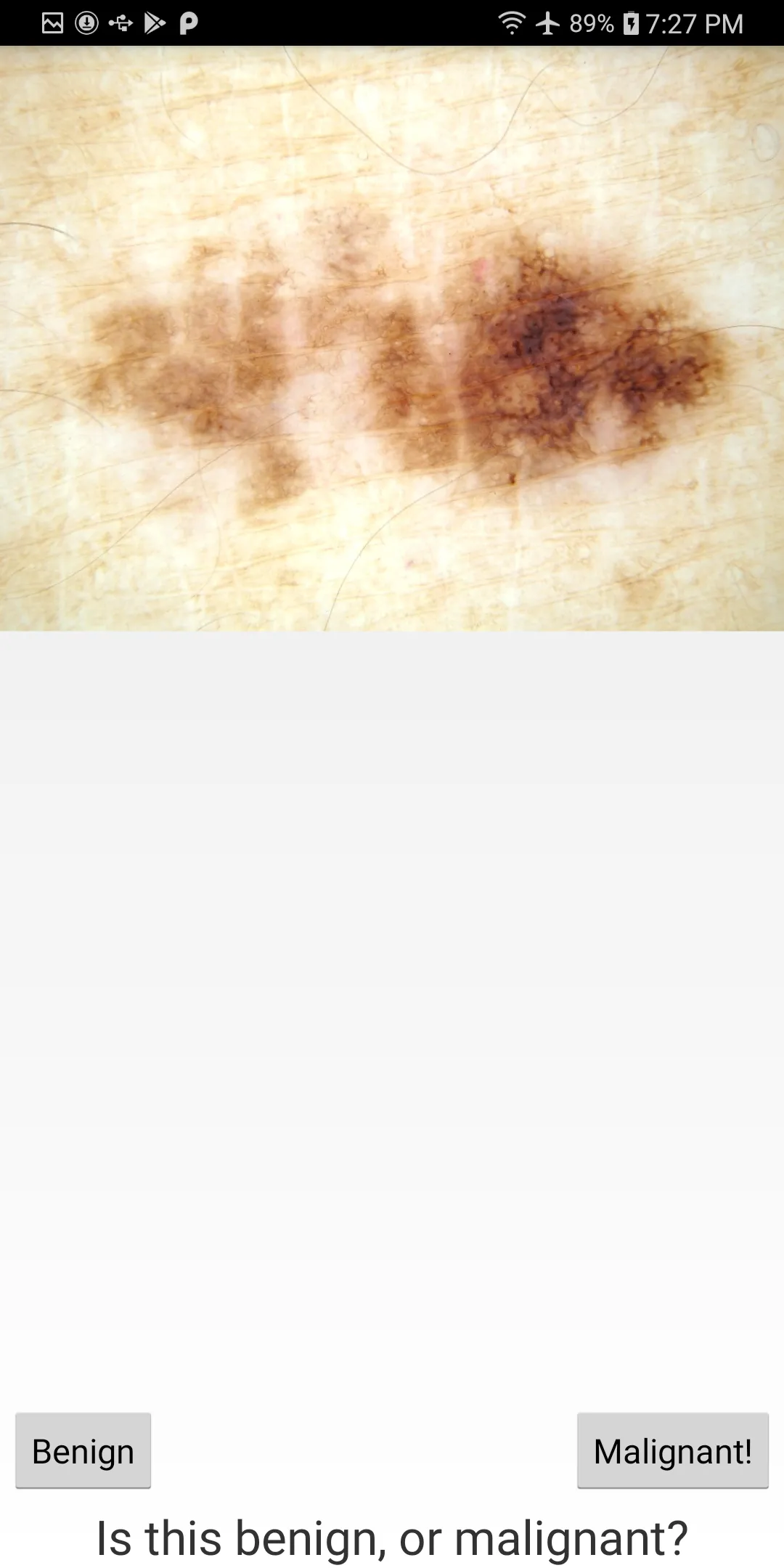 Skin Cancer Flashcard "game" | Indus Appstore | Screenshot