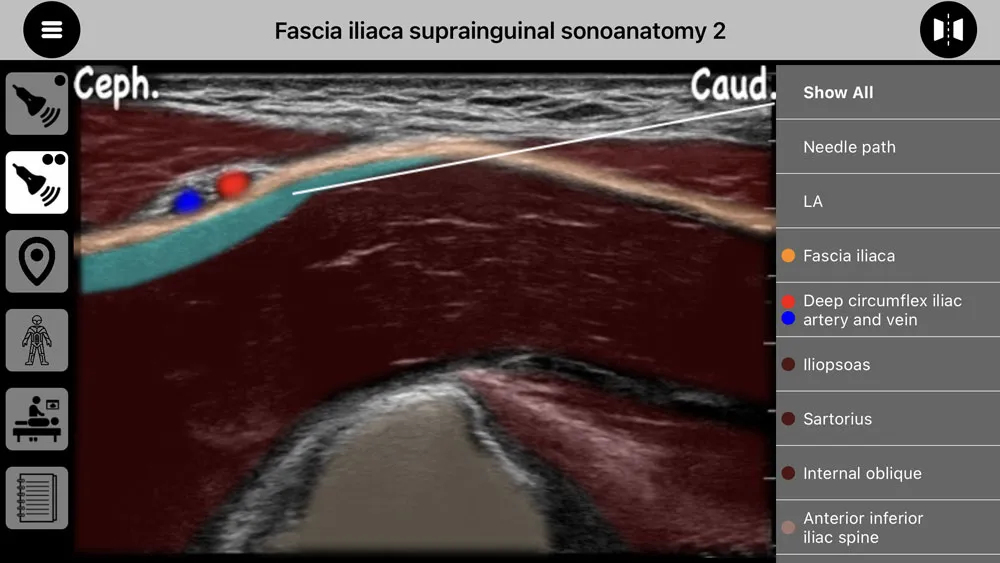 AnSo Anaesthesia Sonoanatomy | Indus Appstore | Screenshot