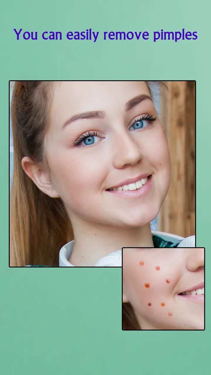 Remove Acne from Face | Indus Appstore | Screenshot