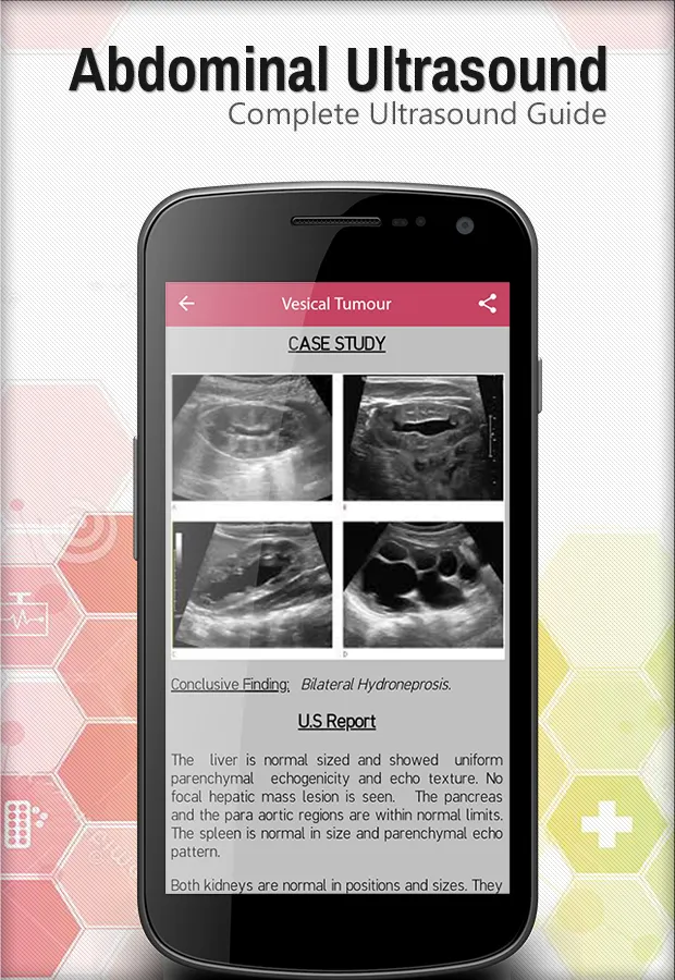 Abdominal Ultrasound Guide | Indus Appstore | Screenshot