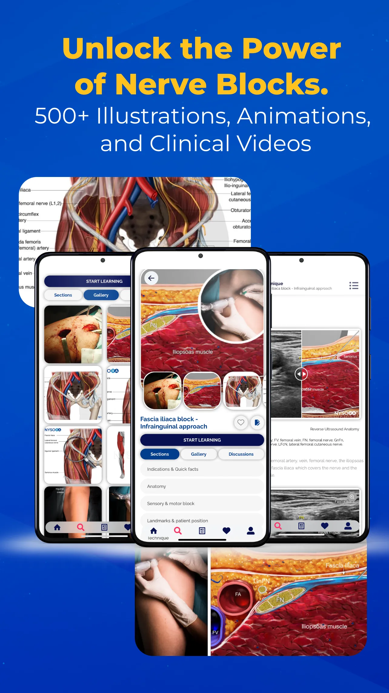 NYSORA Nerve Blocks | Indus Appstore | Screenshot