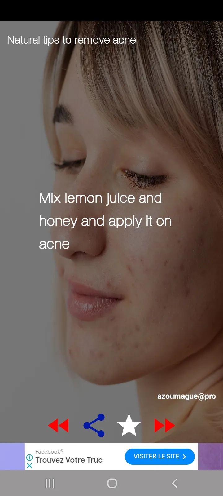 Acne Removal Tips Natural | Indus Appstore | Screenshot