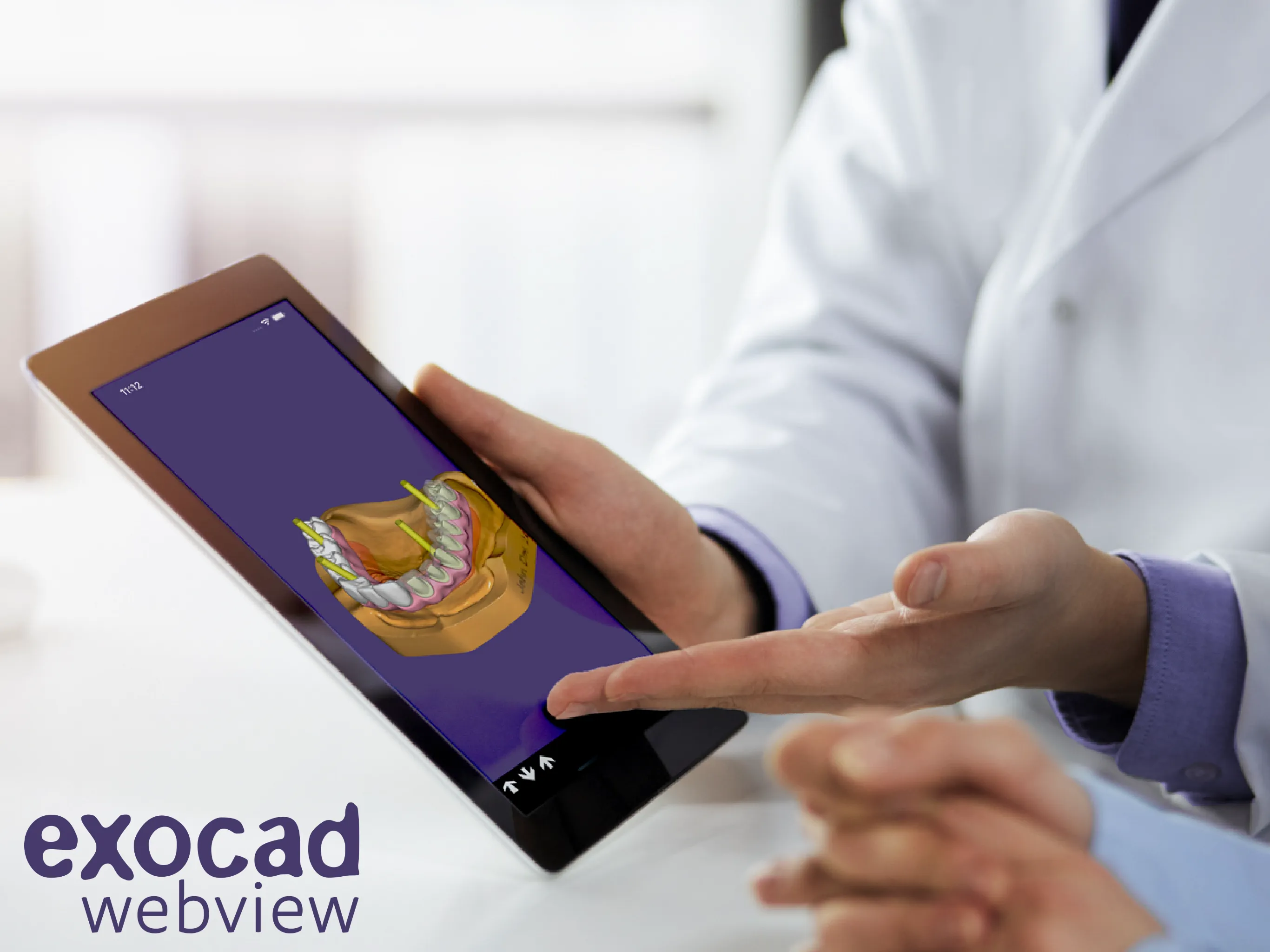 exocad webview - STL 3D Viewer | Indus Appstore | Screenshot