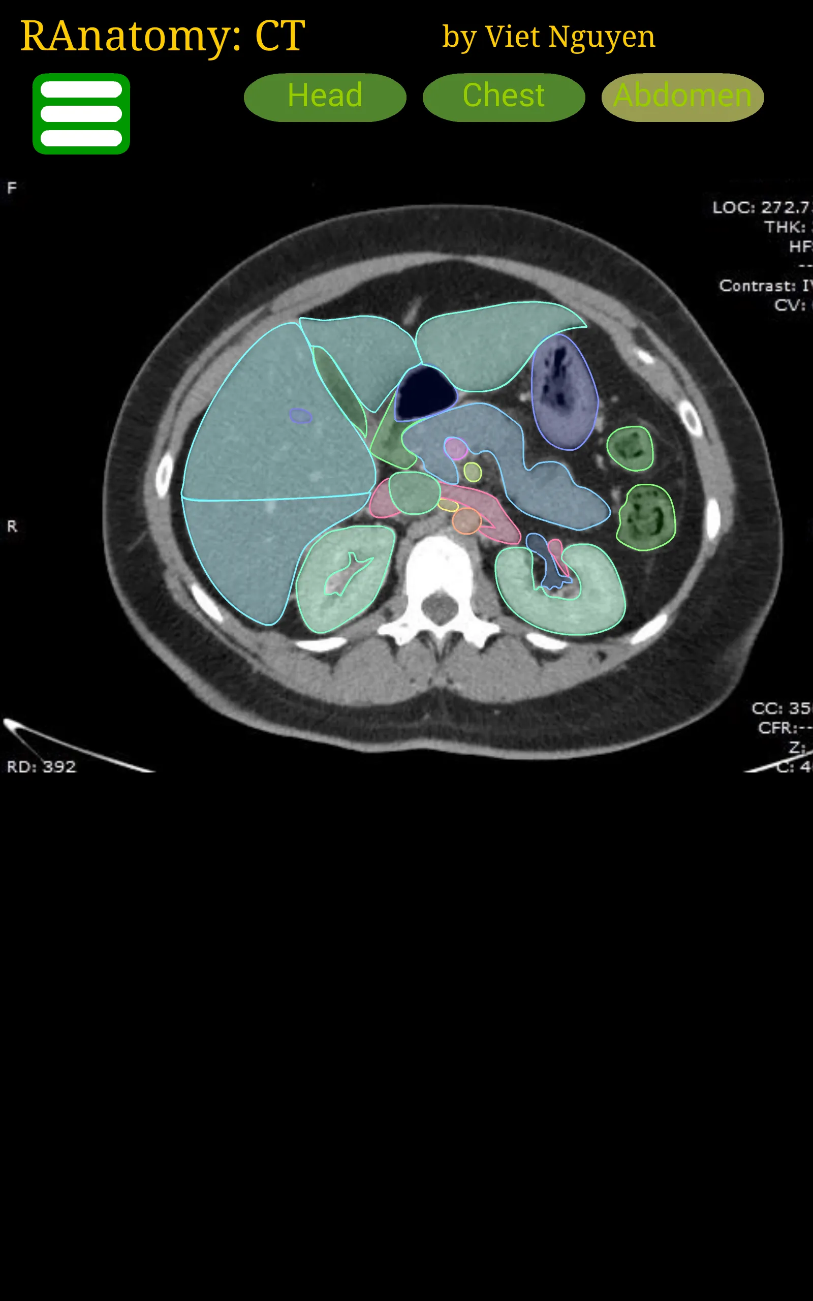 Radiology CT Anatomy | Indus Appstore | Screenshot