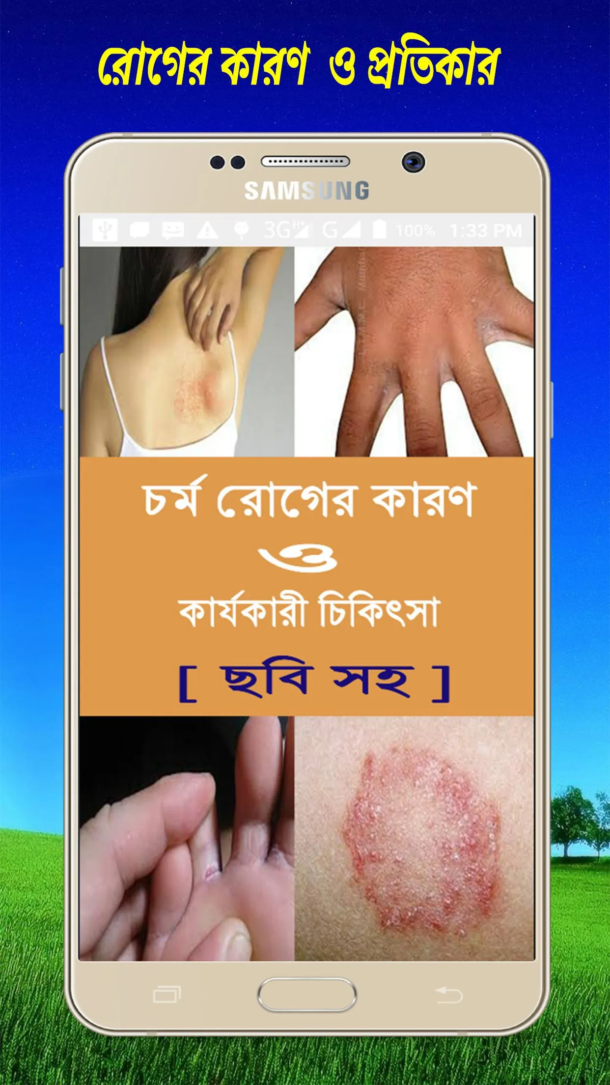 চর্ম রোগের কারণ  ও  চিকিৎসা | Indus Appstore | Screenshot