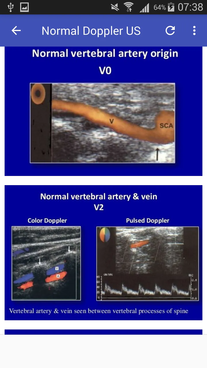 Doppler US Of Carotid arteries | Indus Appstore | Screenshot