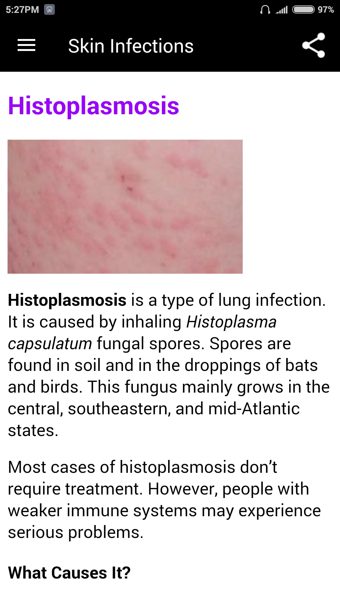 Skin Infections | Indus Appstore | Screenshot