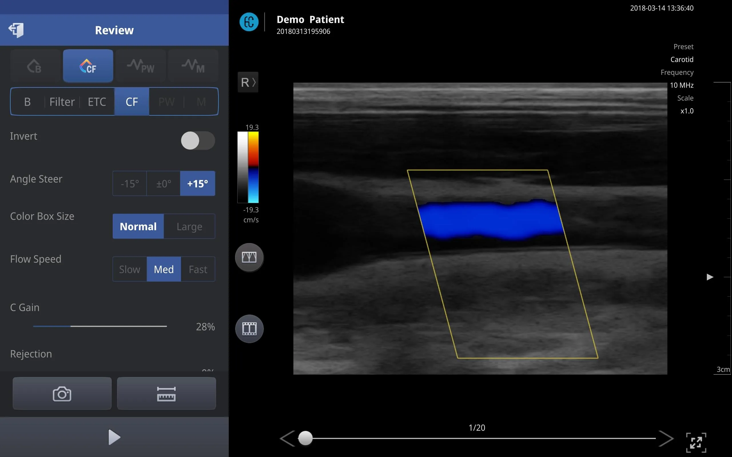 SONON X Ultrasound App | Indus Appstore | Screenshot