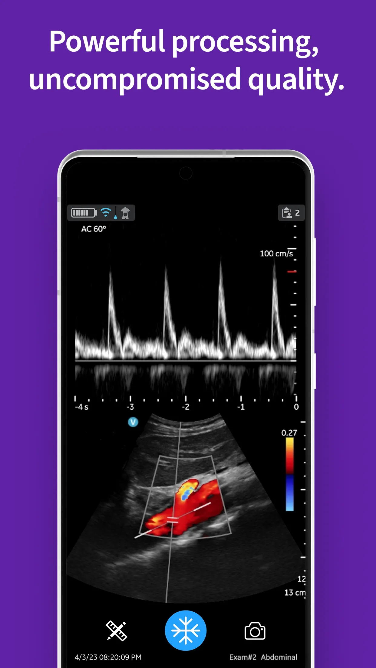 Vscan Air Wireless Ultrasound | Indus Appstore | Screenshot