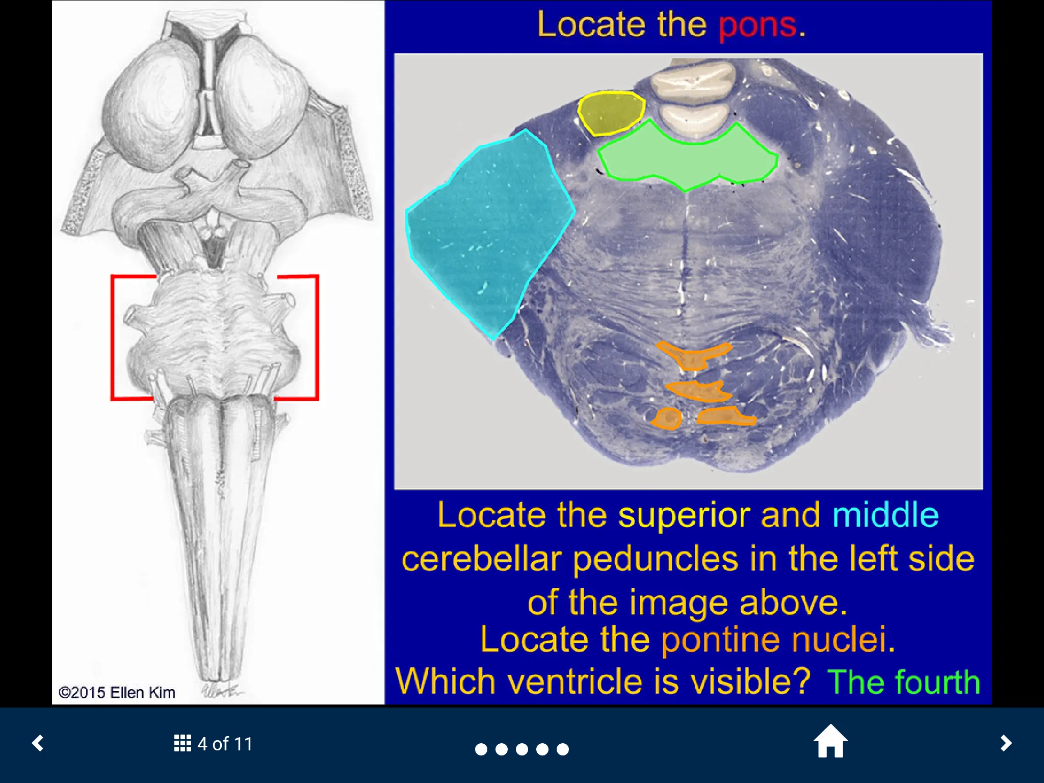 Neuroanatomy - SecondLook | Indus Appstore | Screenshot