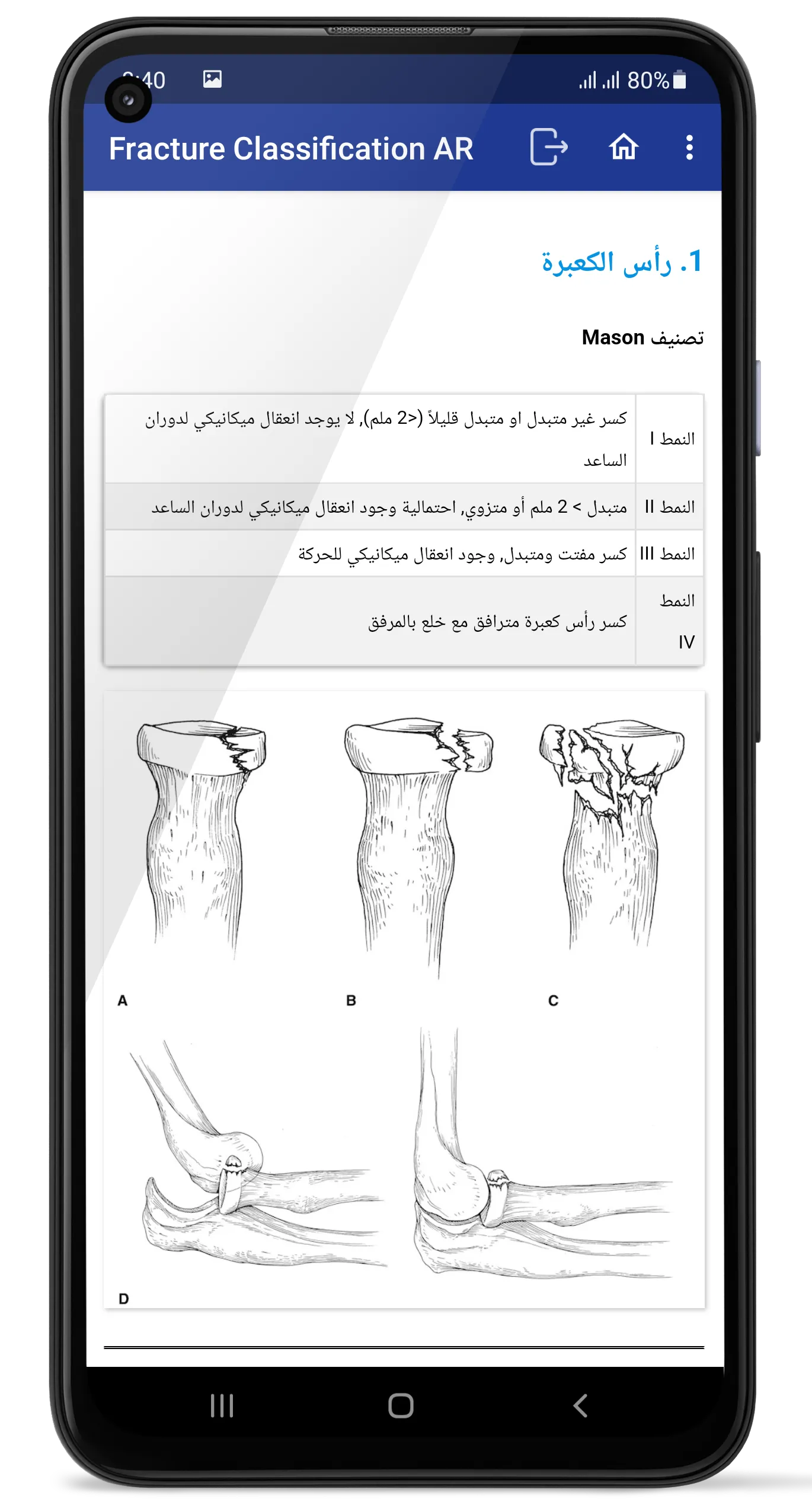 تصنيف الكسور بالجراحة العظمية | Indus Appstore | Screenshot