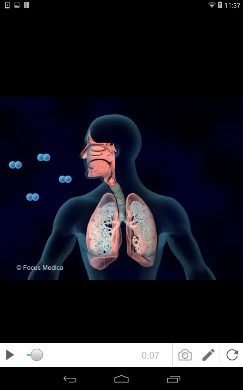 Chronic Asthma | Indus Appstore | Screenshot