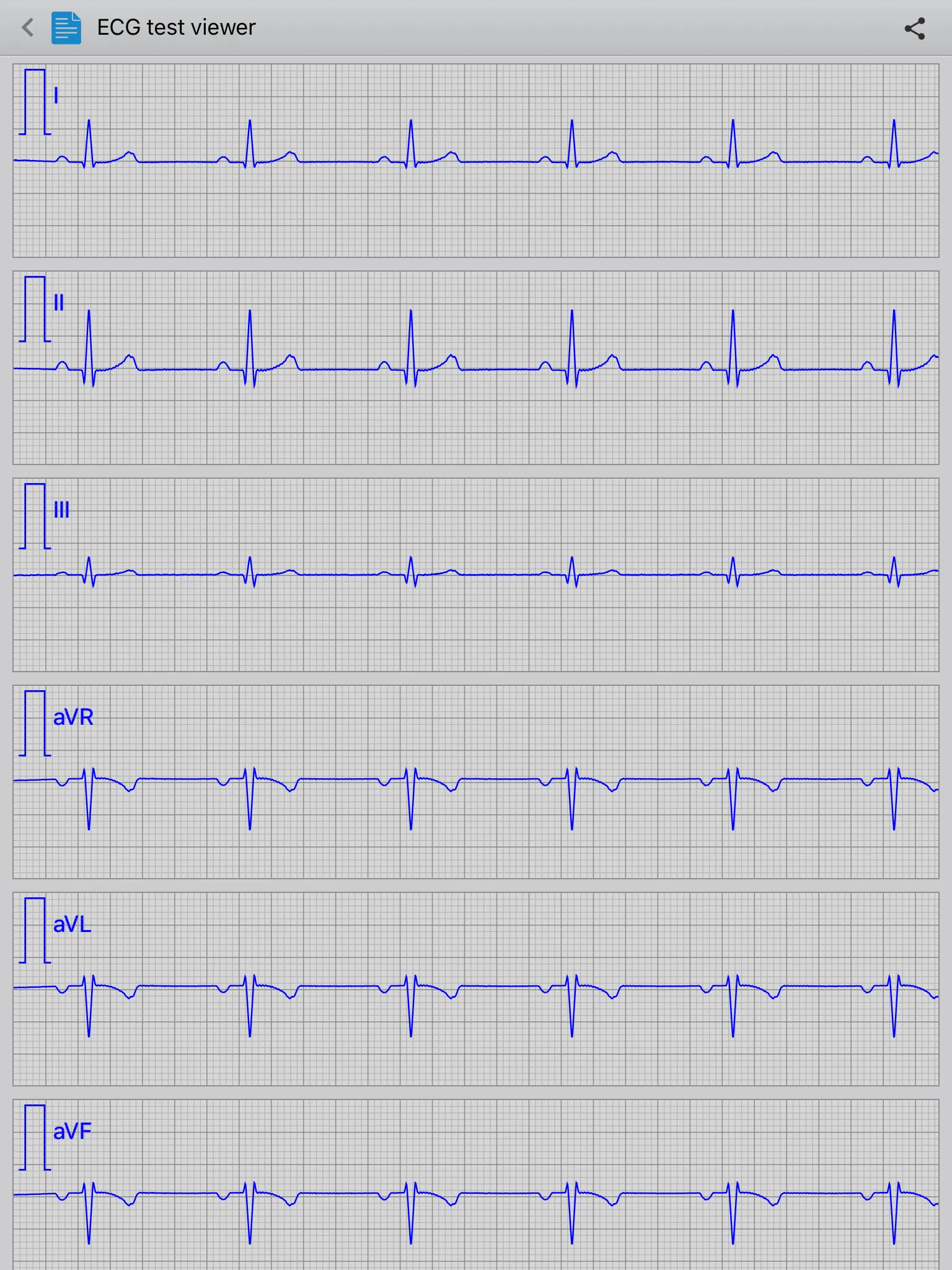 Istel ECG | Indus Appstore | Screenshot