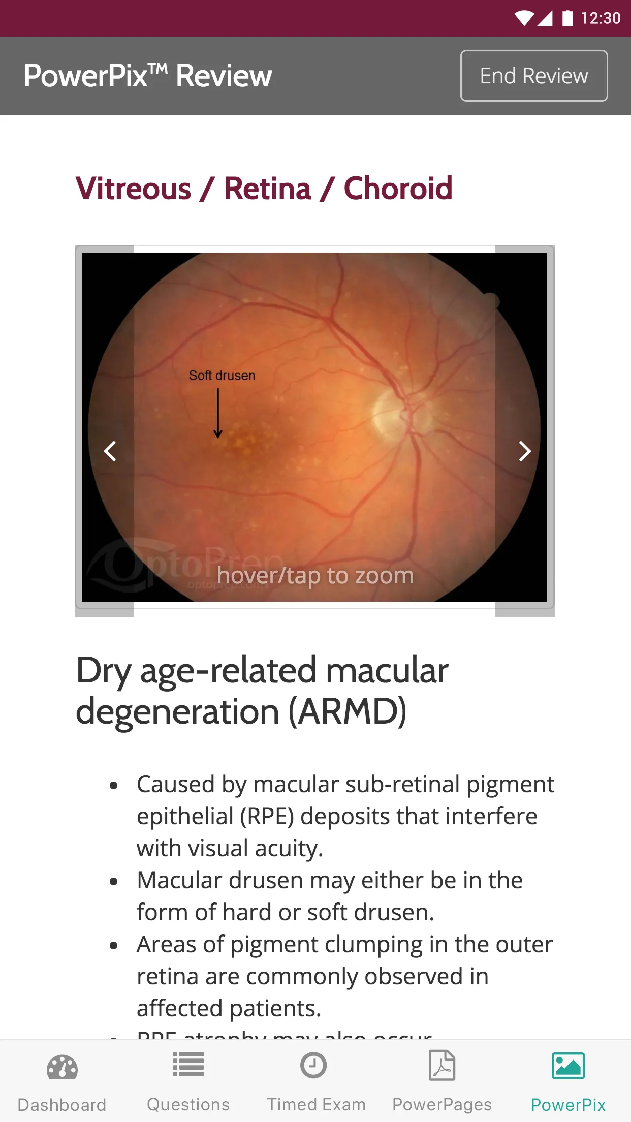 OptoPrep - Study for NBEO® PI | Indus Appstore | Screenshot