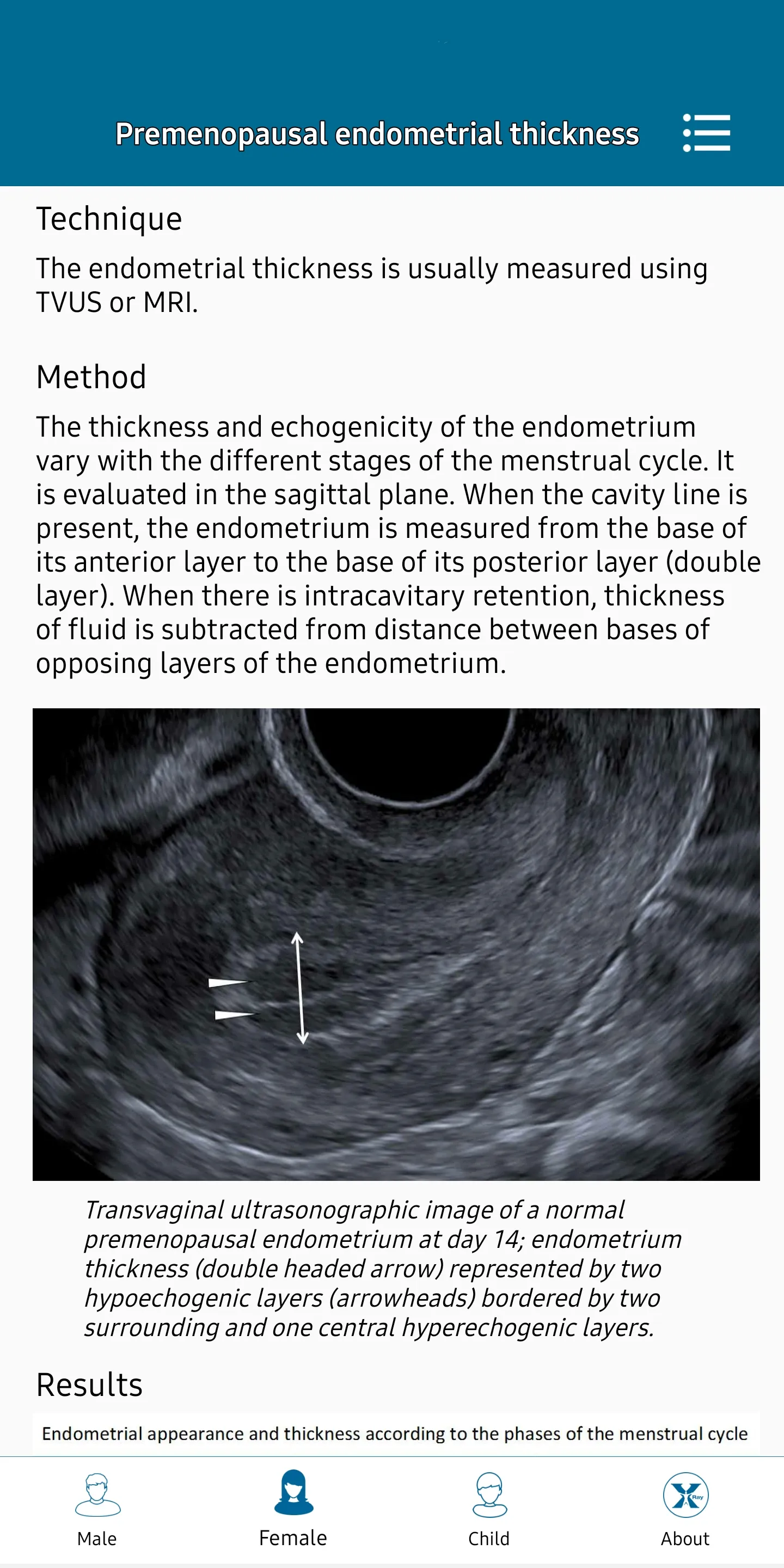 Radiology Measurements | Indus Appstore | Screenshot