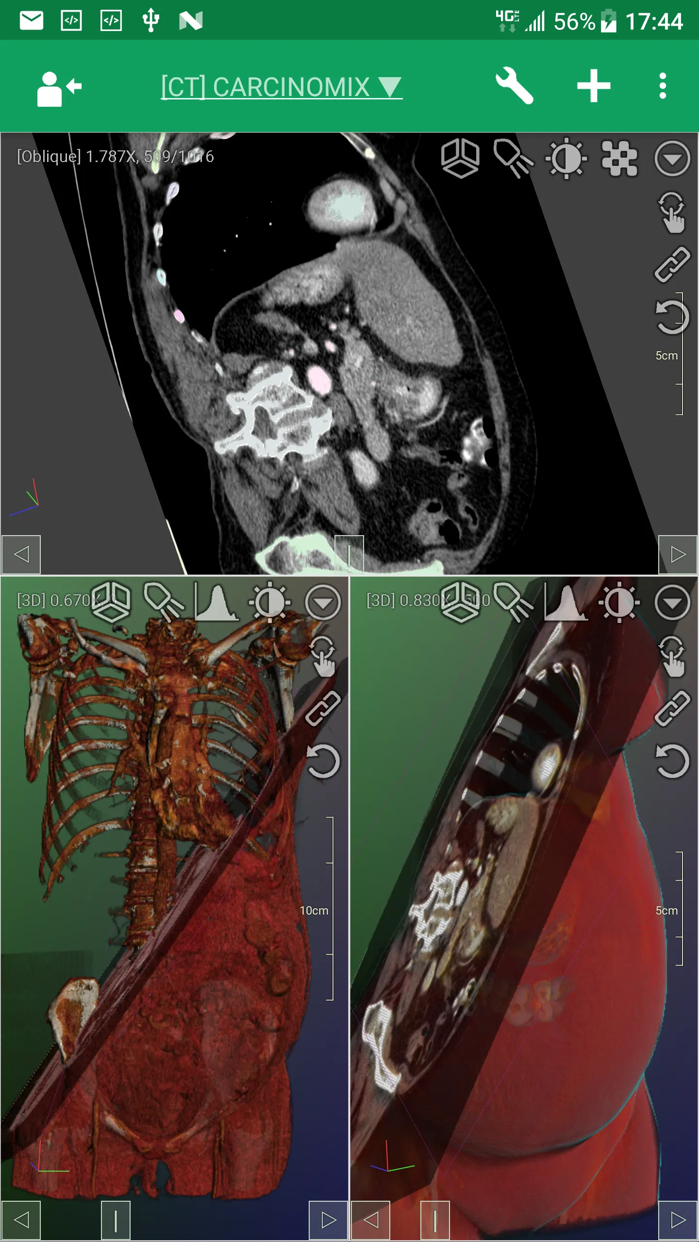 DroidRender - 3D DICOM viewer | Indus Appstore | Screenshot