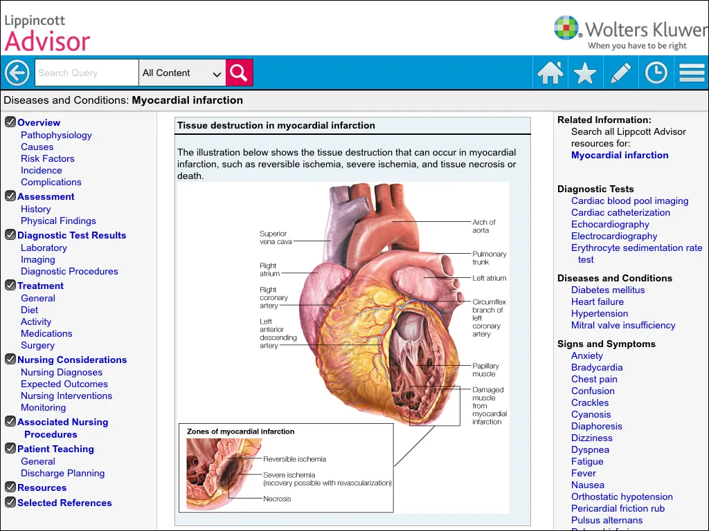 Lippincott Nursing Advisor | Indus Appstore | Screenshot