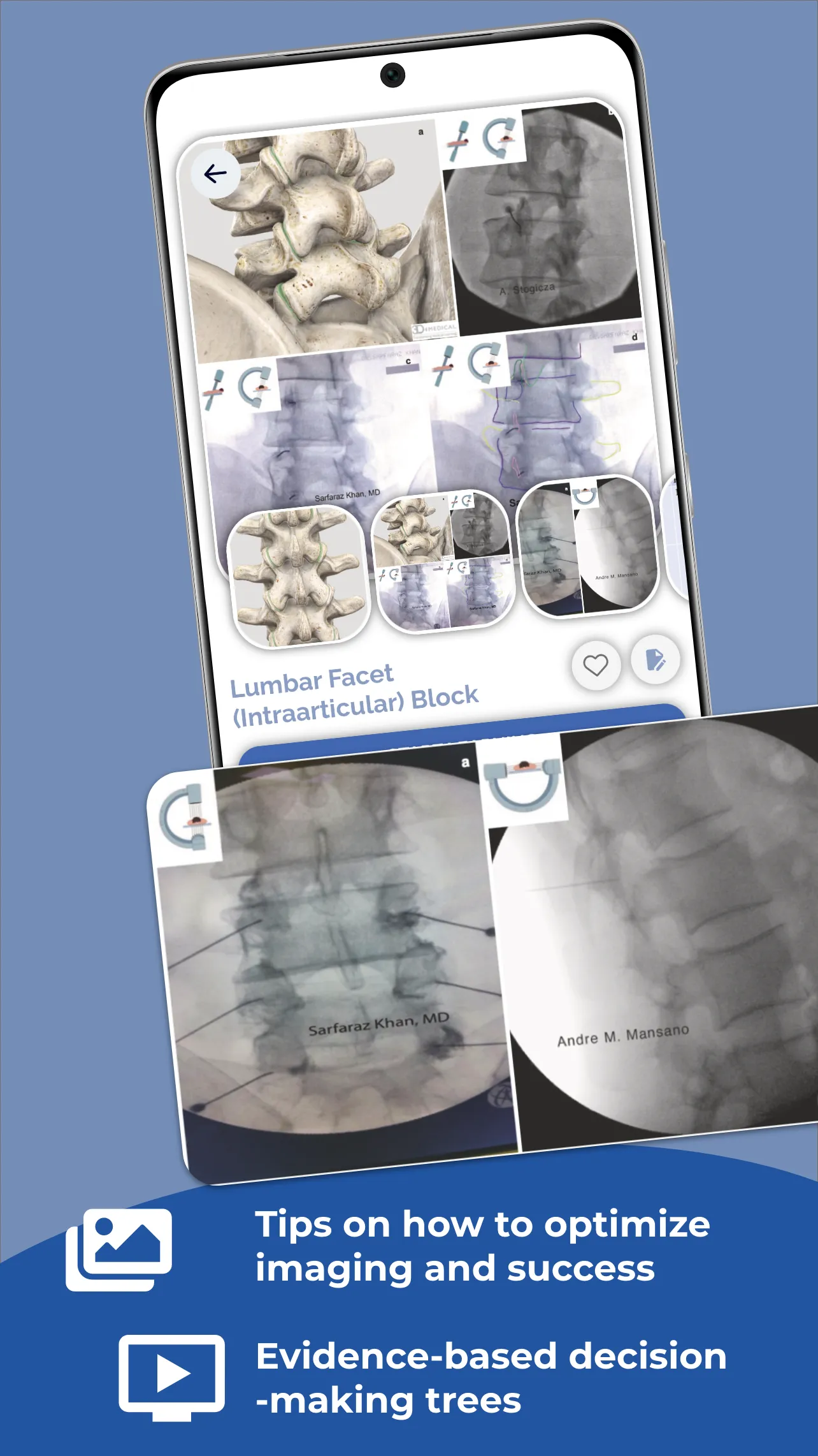 Interventional Pain App | Indus Appstore | Screenshot