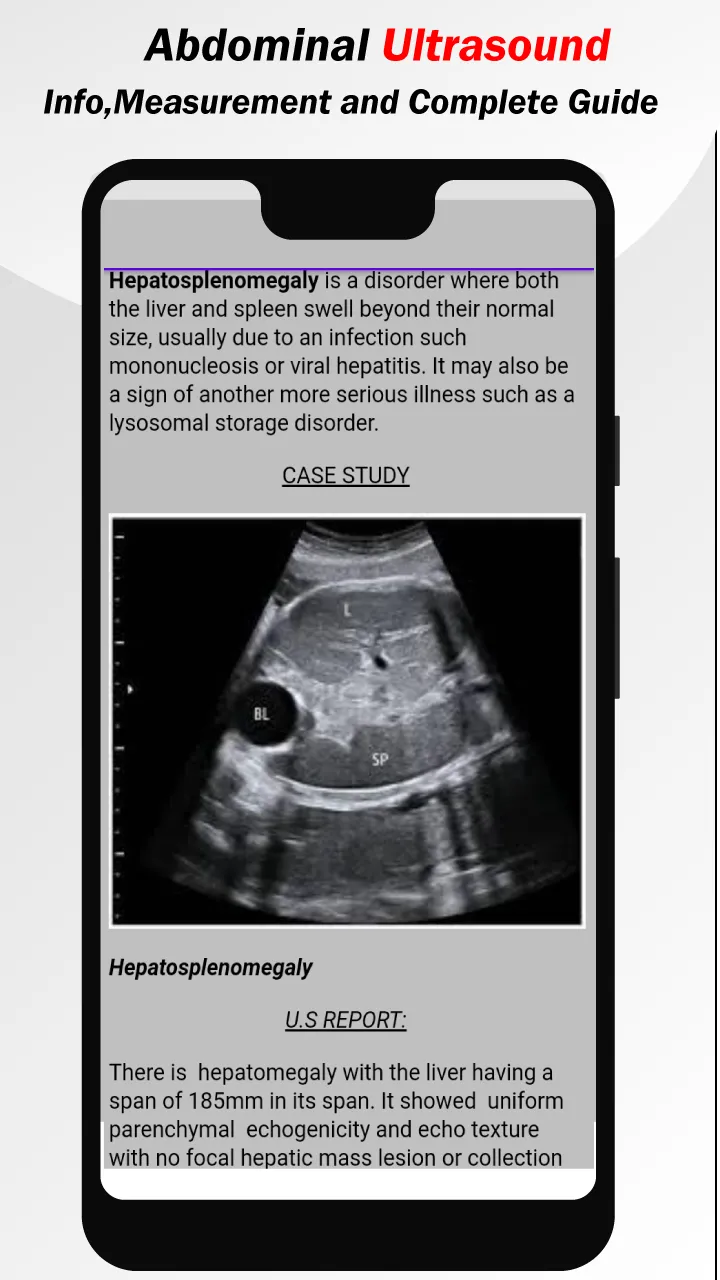 Abdominal Ultrasound Guide | Indus Appstore | Screenshot