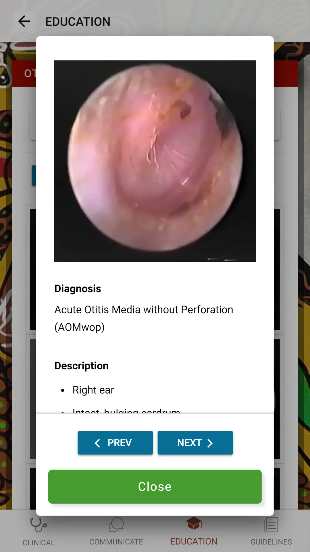 Otitis Media Guidelines | Indus Appstore | Screenshot