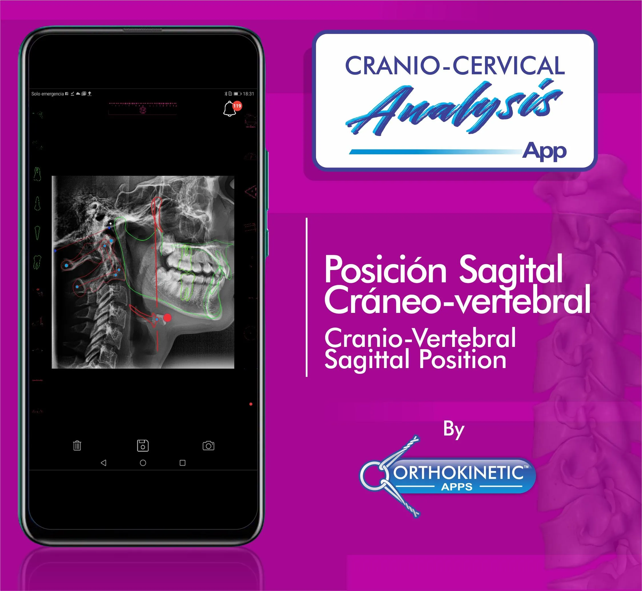 Cranio-cervical Analysis by Or | Indus Appstore | Screenshot