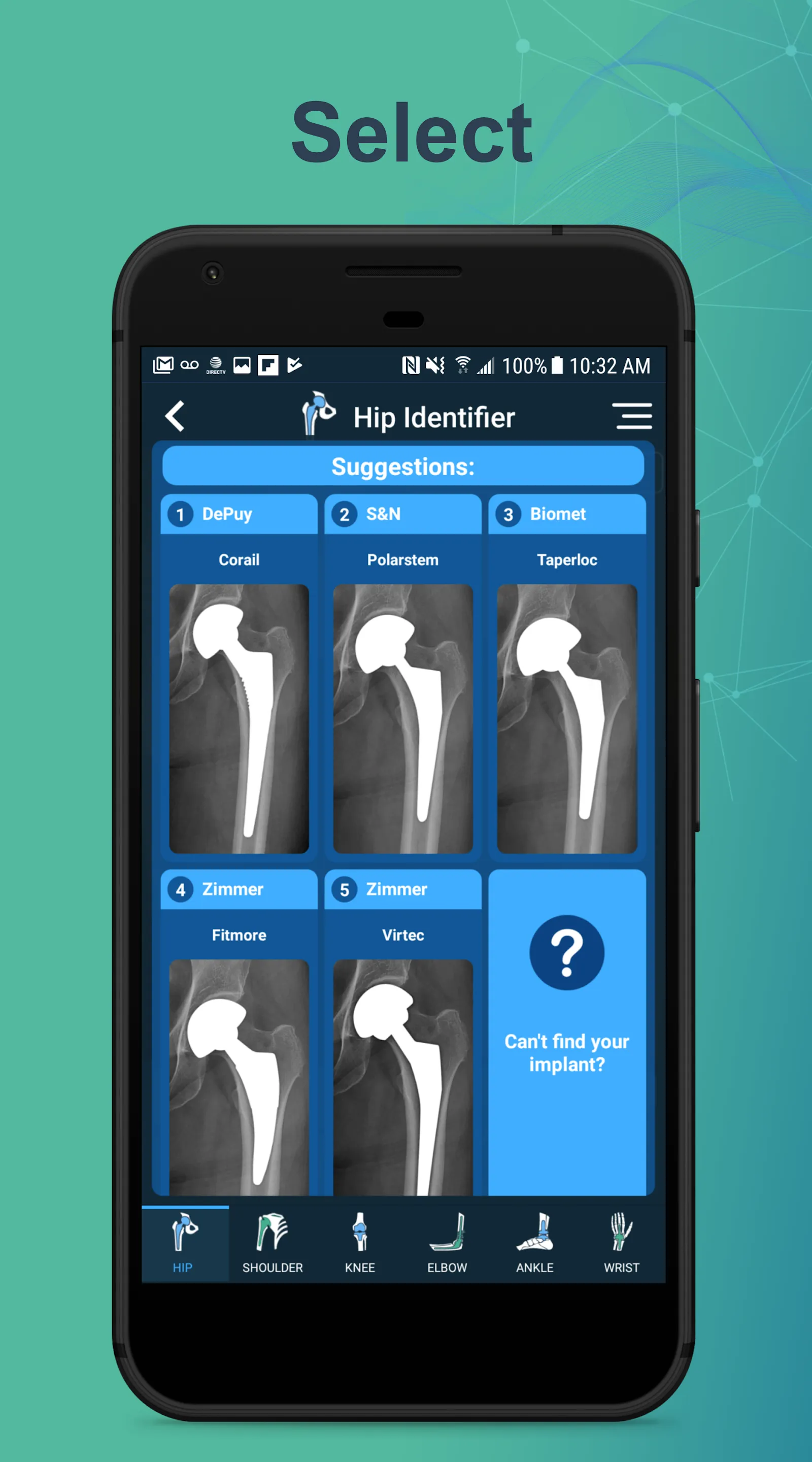 Implant Identifier | Indus Appstore | Screenshot