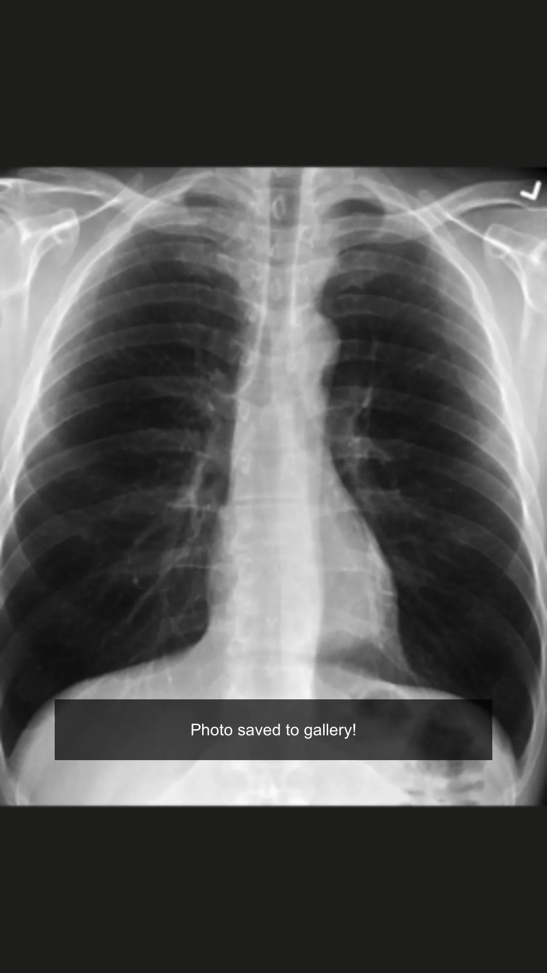 Xray scan filter camera | Indus Appstore | Screenshot