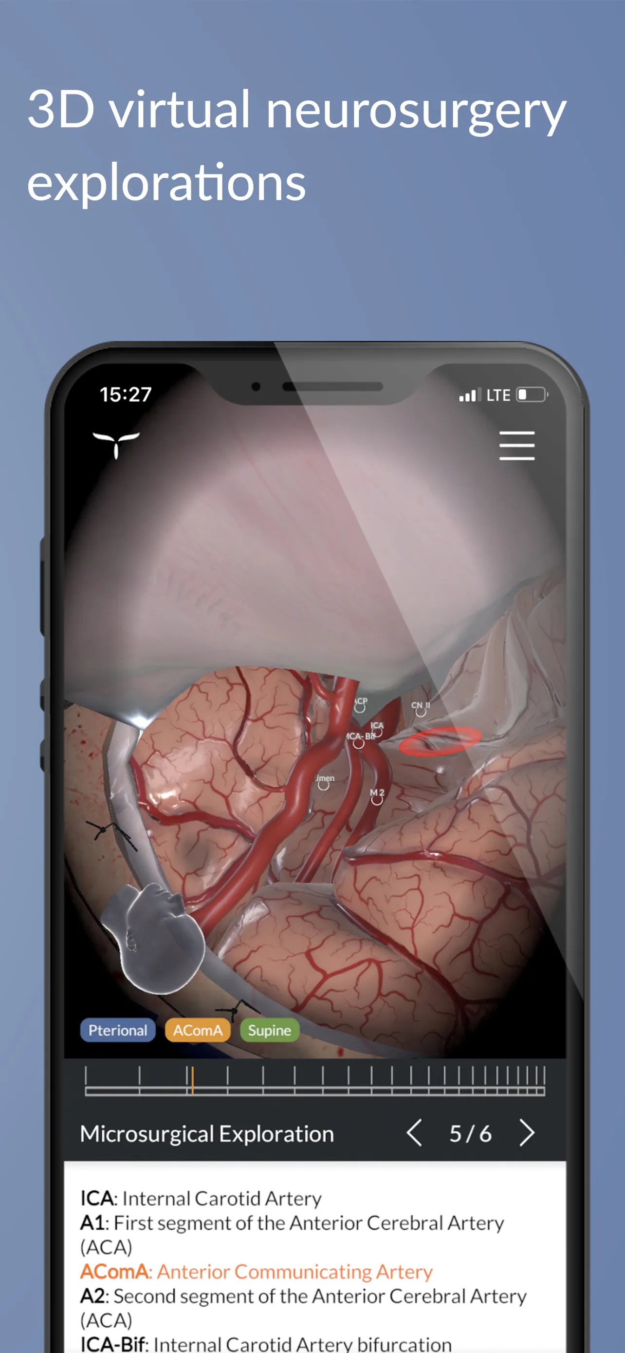 UpSurgeOn Neurosurgery | Indus Appstore | Screenshot