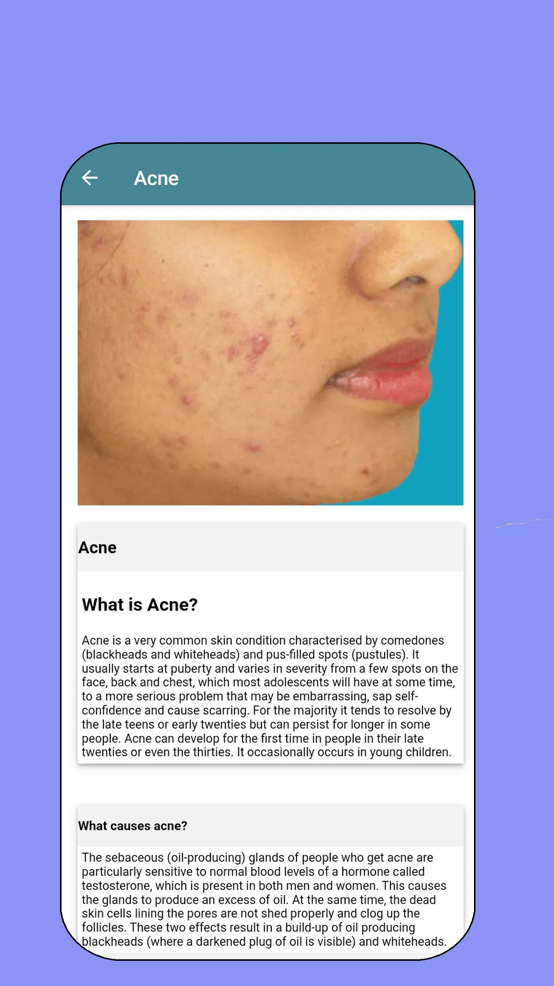 Skin diseases and treatment | Indus Appstore | Screenshot