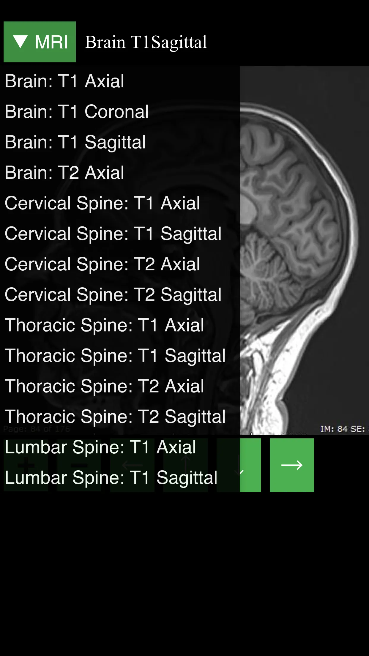 MRI Viewer | Indus Appstore | Screenshot