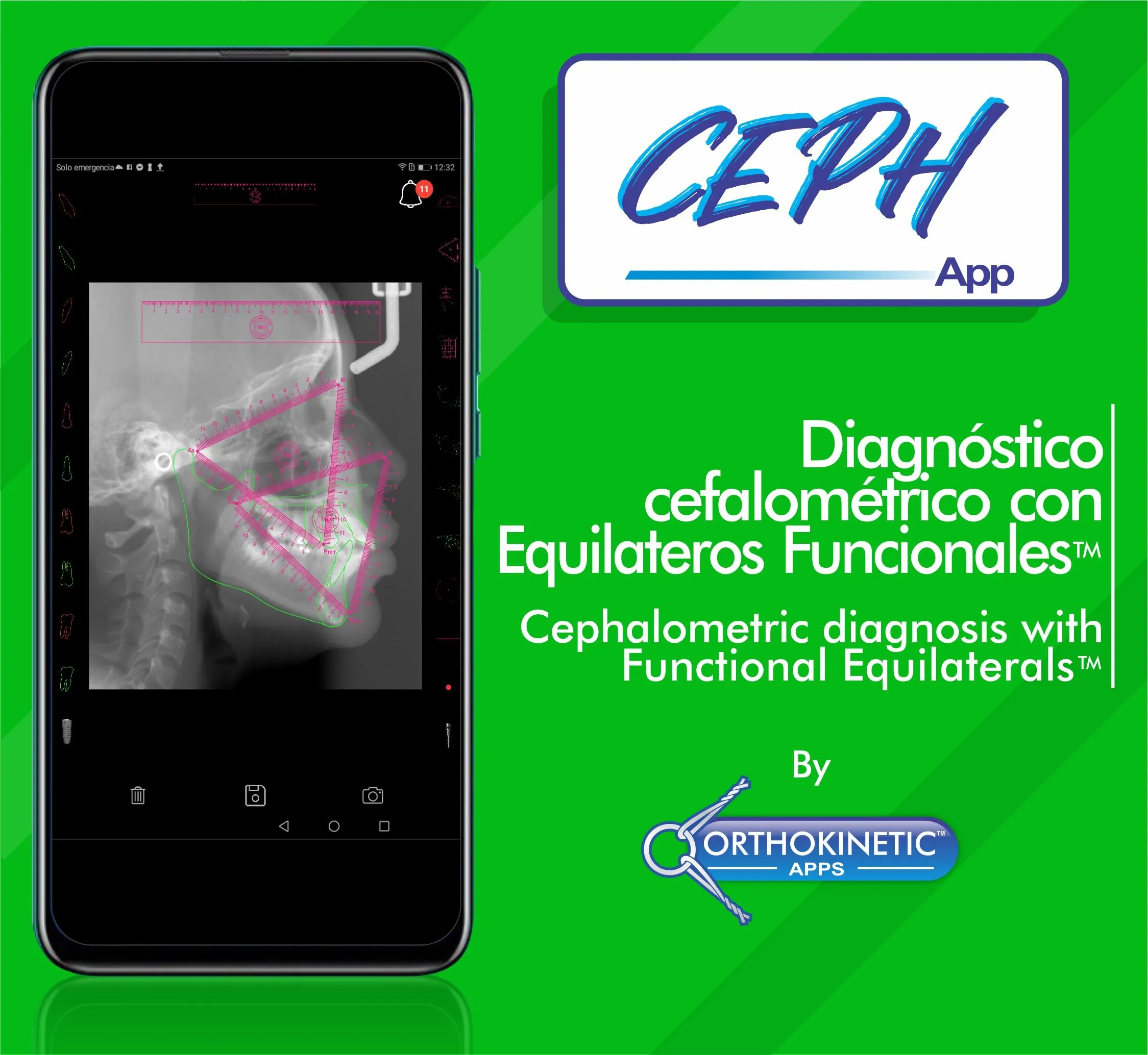 CEPH App by ORTHOKINETIC APPS | Indus Appstore | Screenshot