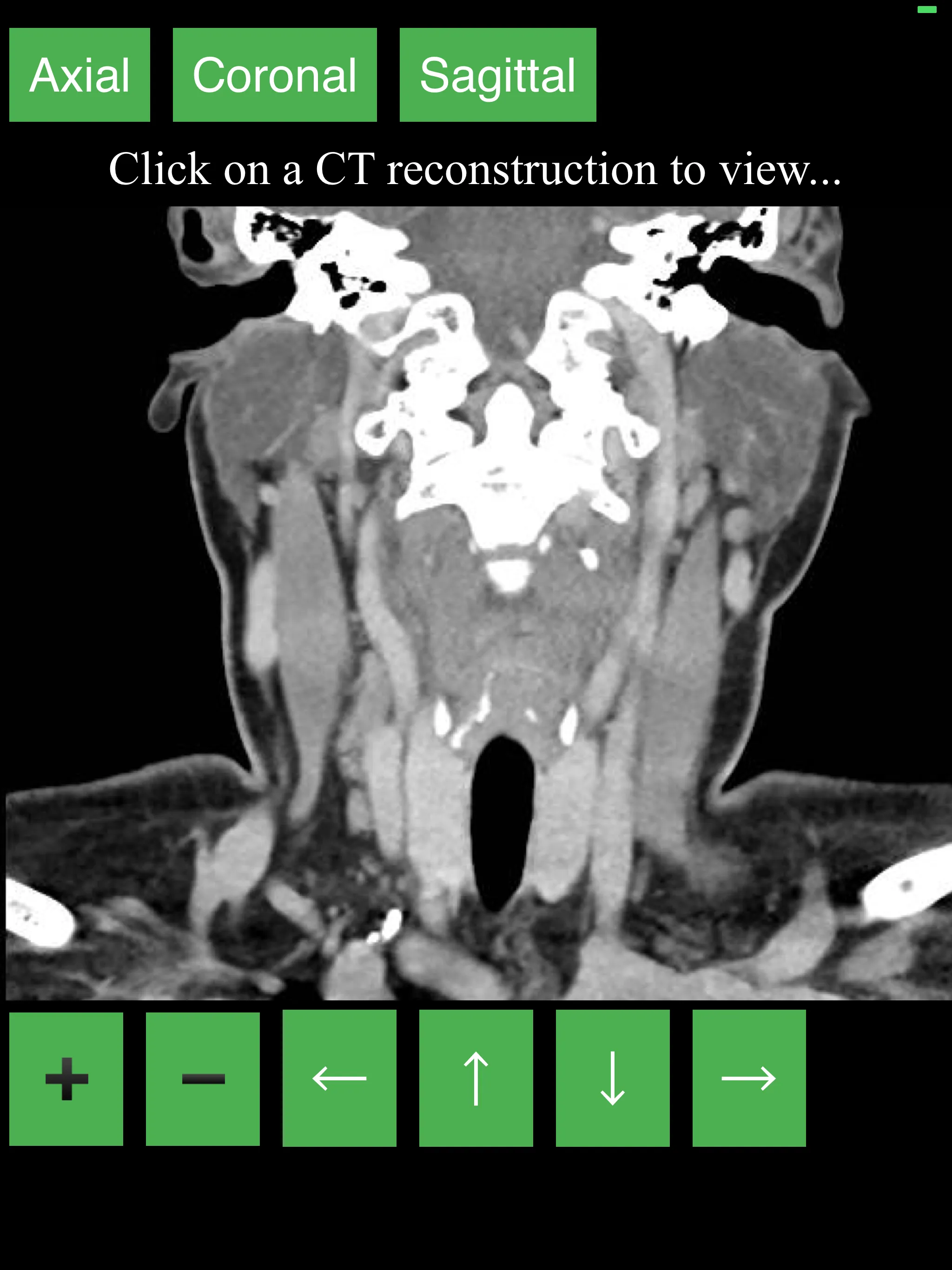 CT Neck | Indus Appstore | Screenshot