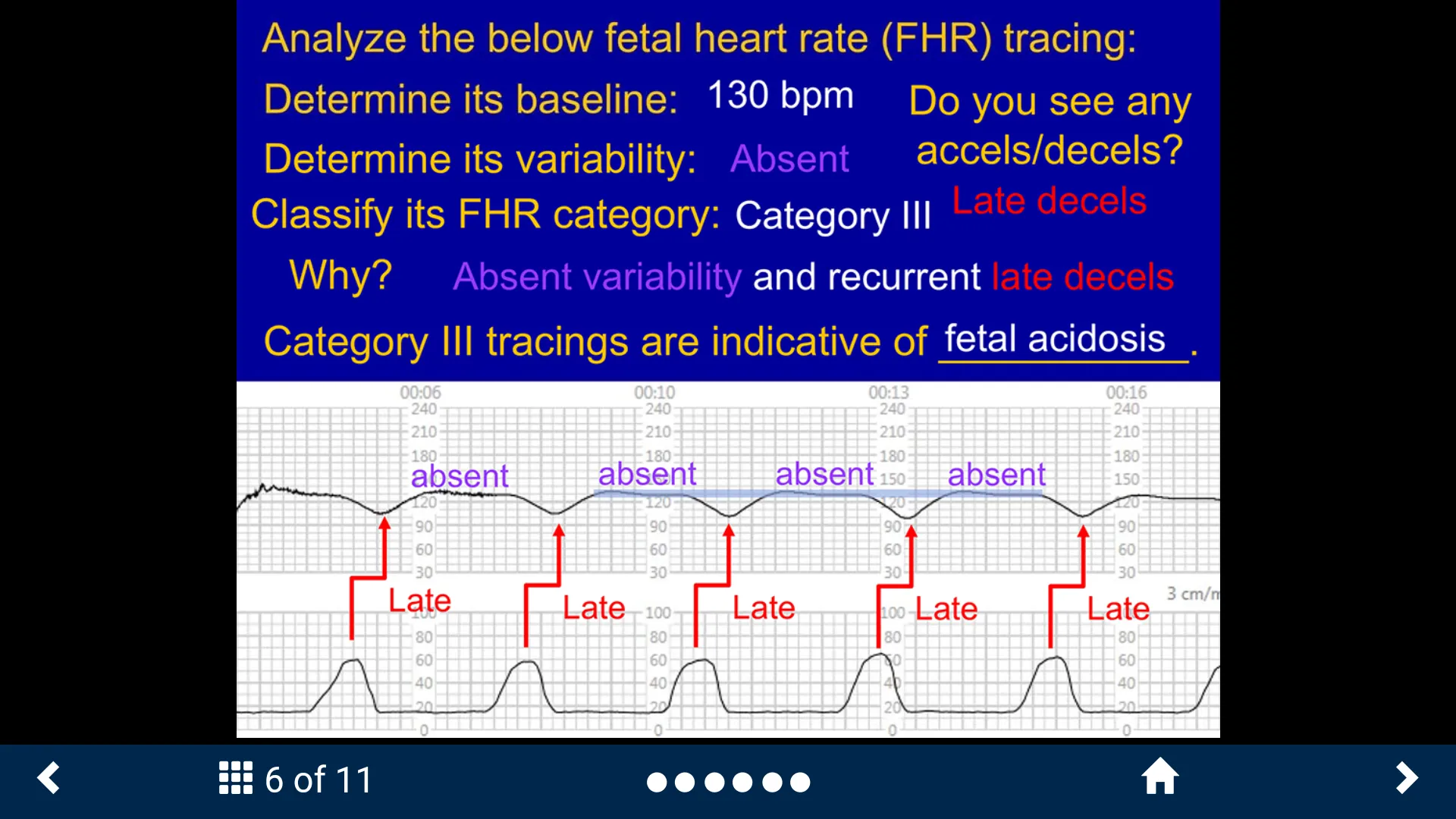 Fetal Heart Rate - SecondLook | Indus Appstore | Screenshot