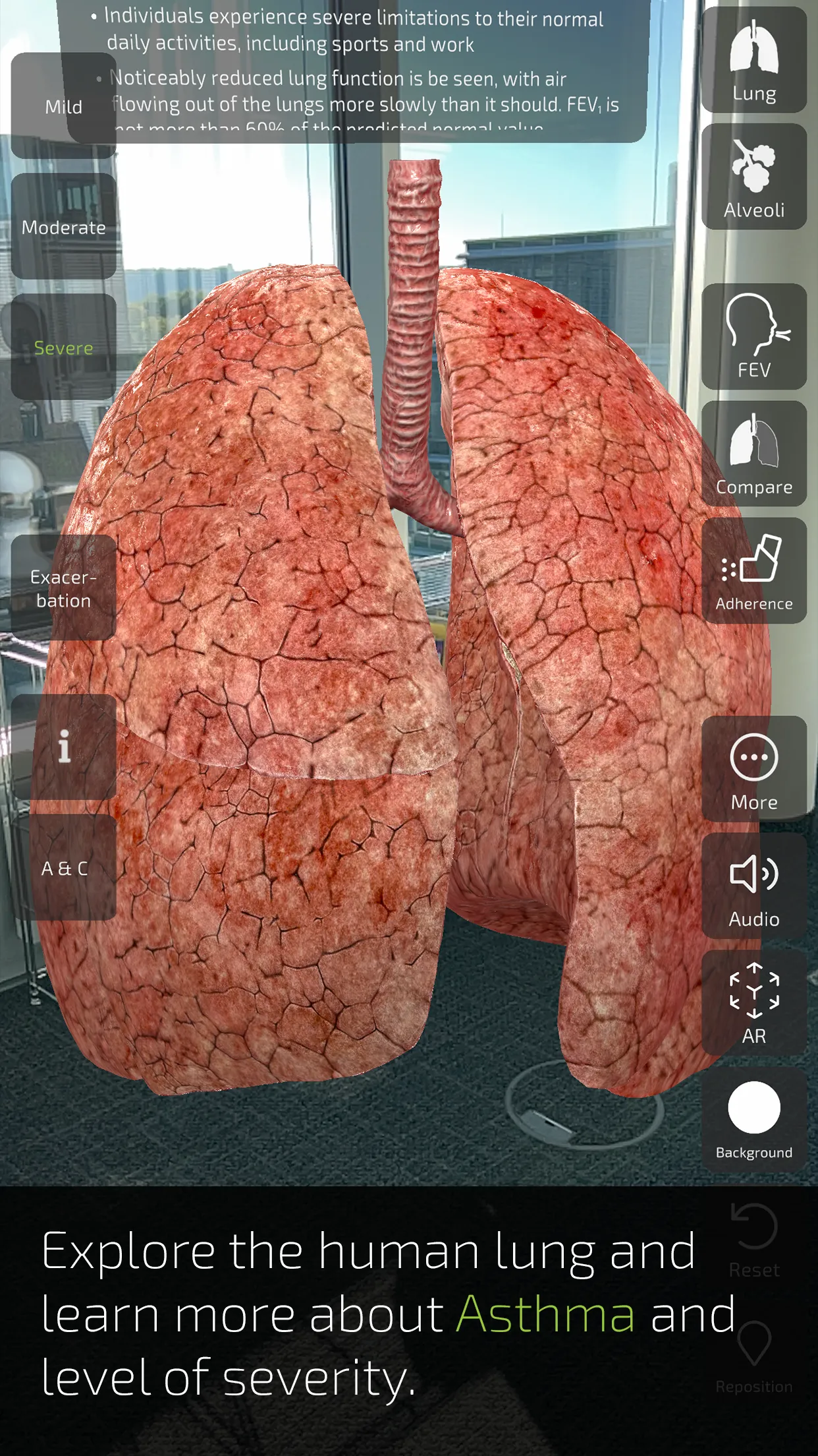 INSIGHT LUNG | Indus Appstore | Screenshot