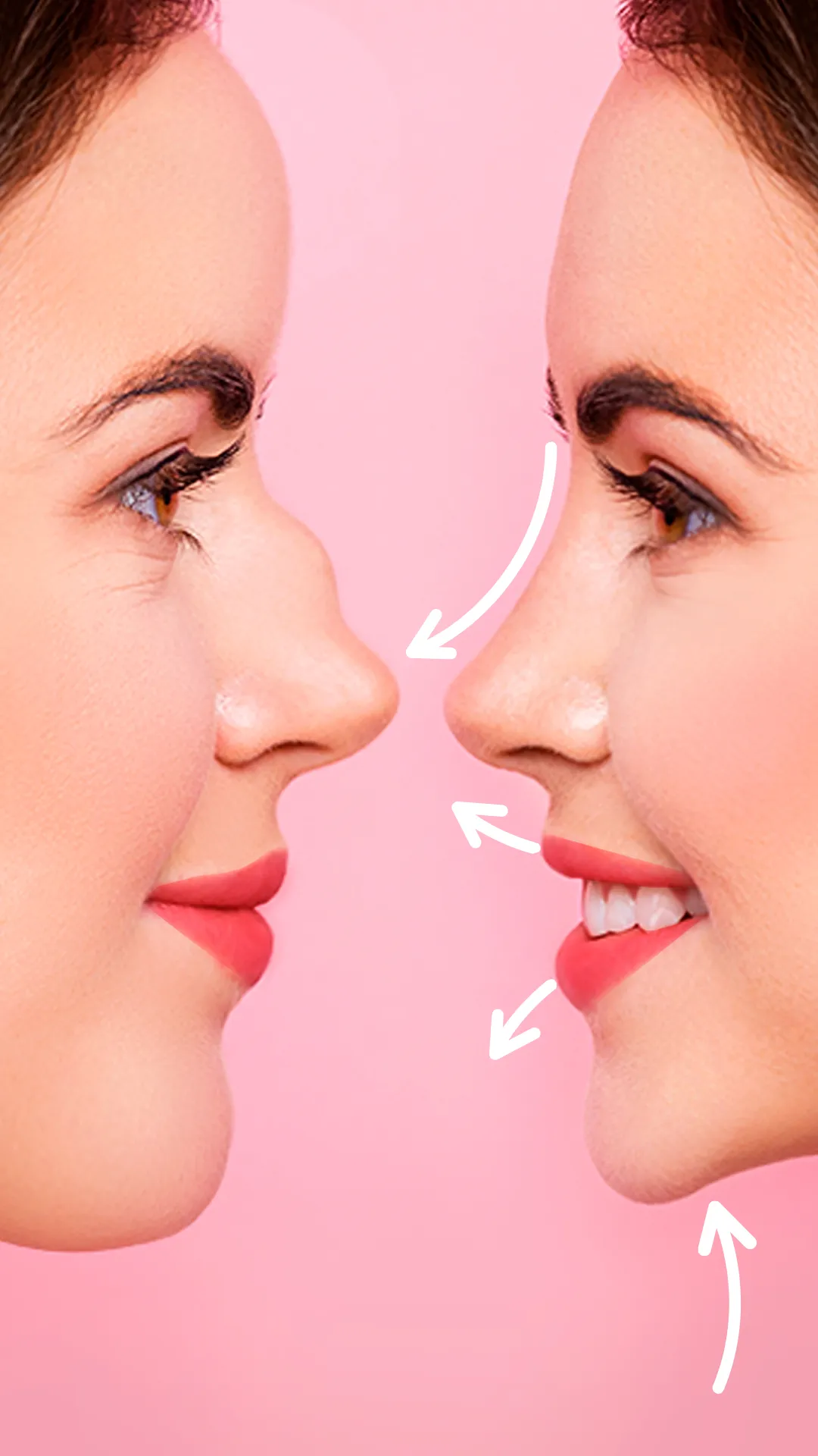 Rhinoplasty App: Nose Editor | Indus Appstore | Screenshot