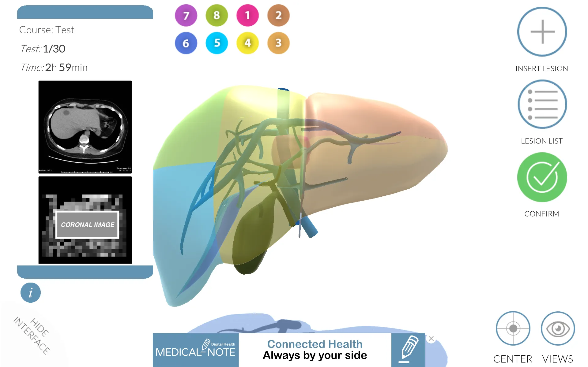 LIVER-NOTE.Edu | Indus Appstore | Screenshot