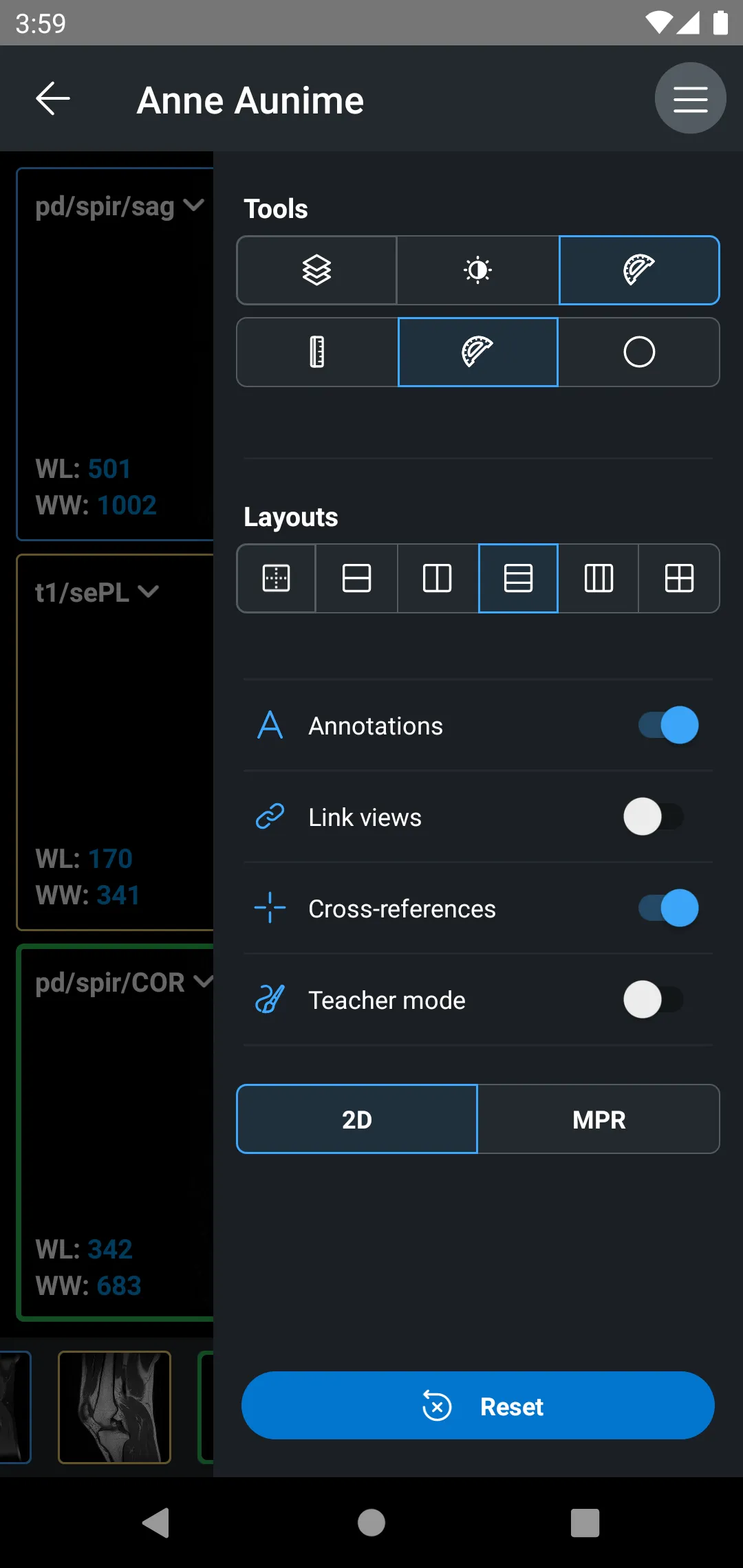 IDV - IMAIOS DICOM Viewer | Indus Appstore | Screenshot