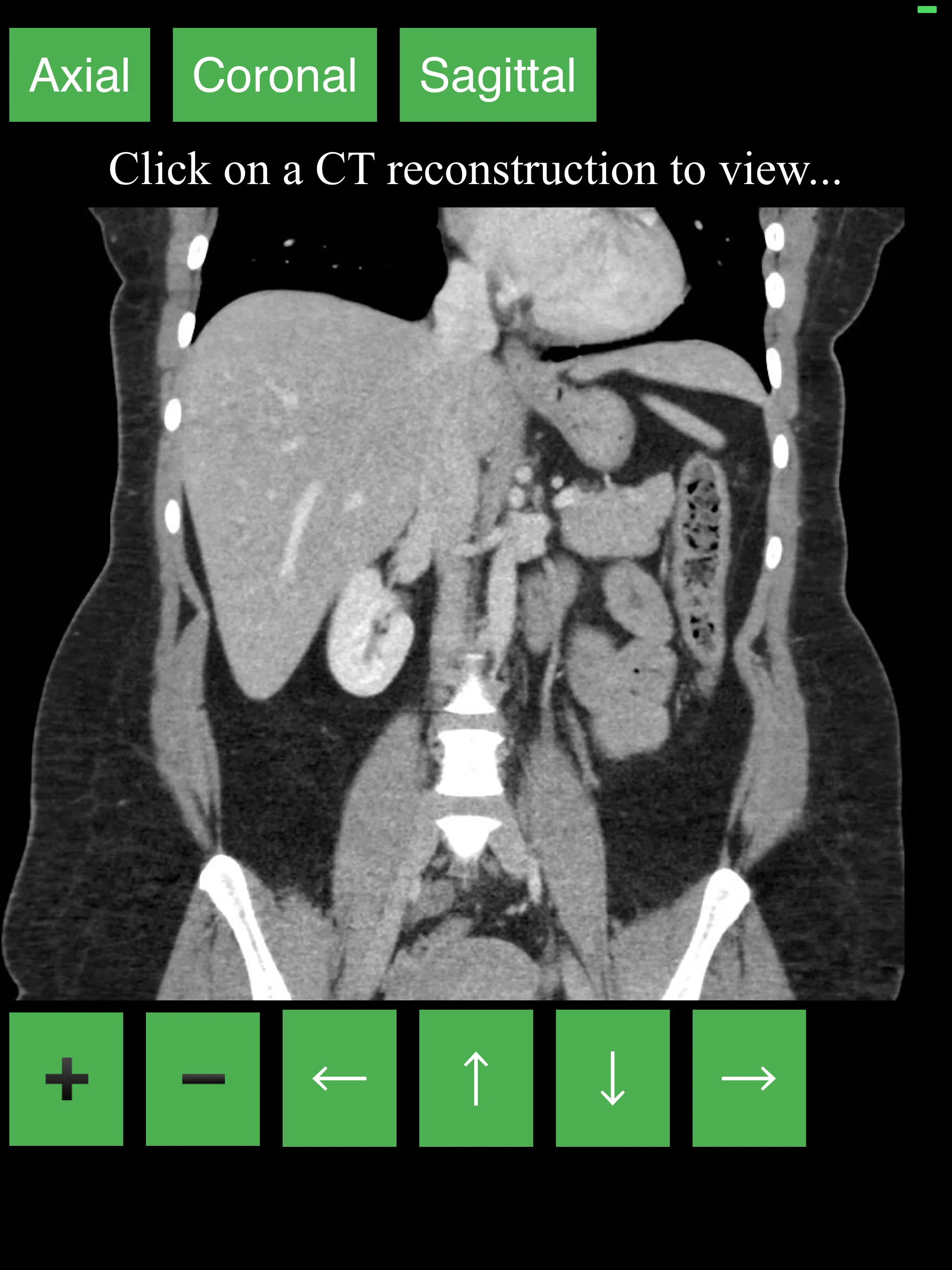 CT Abdomen Pelvis | Indus Appstore | Screenshot