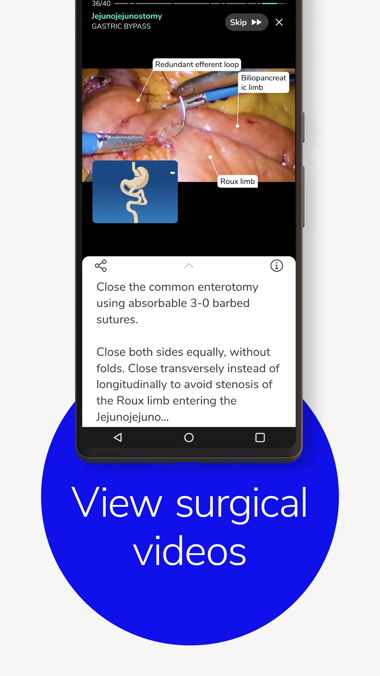 Touch Surgery: Surgical Videos | Indus Appstore | Screenshot