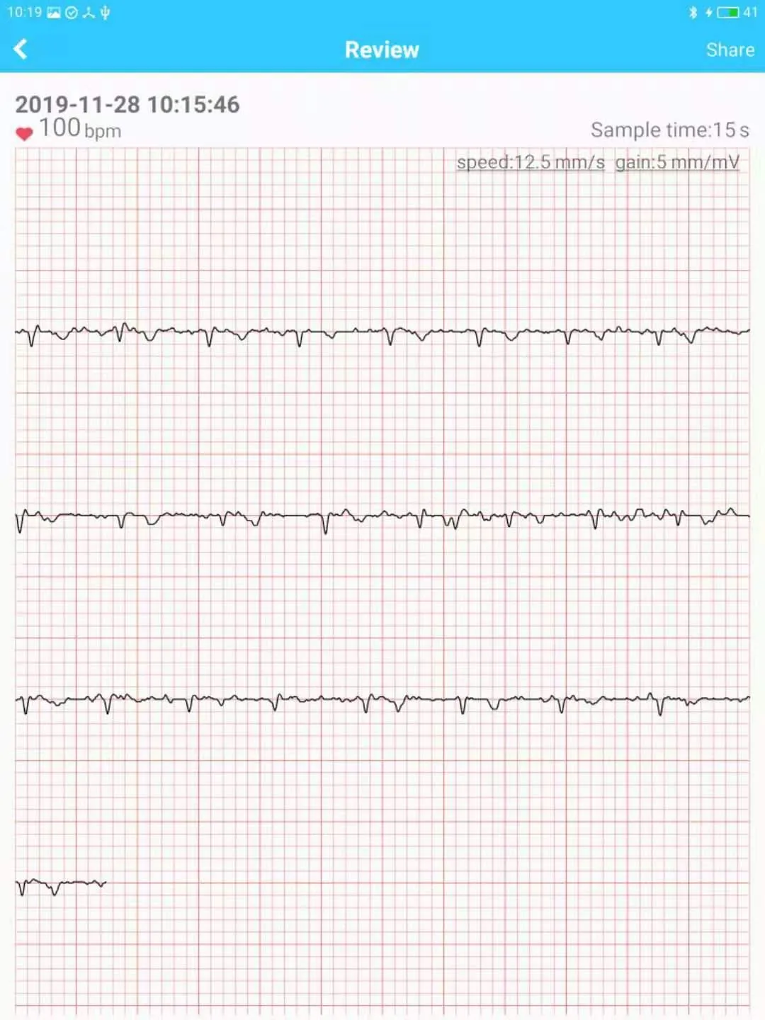 Mini ECG Aide | Indus Appstore | Screenshot